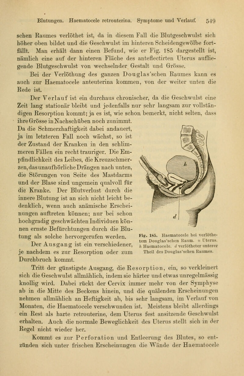 sehen Raumes verlöthet ist, da in diesem Fall die Blutgeschwvilst sich höher oben bildet und die Greschwulst im hinteren Scheidengewölbe fort- fällt. Man erhält dann einen Befund, wie er Fig. 185 dargestellt ist, nämlich eine auf der hinteren Fläche des anteflectirten Uterus auflie- gende Blutgeschwulst Yon wechselnder Gestalt und Grösse. Bei der Verlöthung des ganzen Don glas'sehen Raumes kann es auch zur Haematocele anteuterina kommen, von der weiter unten die Rede ist. Der Verlauf ist ein durchaus chronischer, da die Geschwulst eine Zeit lang stationär bleibt und jedenfalls nur sehr langsam zur vollstän- digen Resorption kommt; ja es ist, wie schon bemerkt, nicht selten, dass ihre Grösse inNachschüben noch zunimmt. Da die Schmerzhaftigkeit dabei andauert, ja im letzteren Fall noch wächst, so ist der Zustand der Kranken in den schlim- meren Fällen ein recht trauriger. Die Em- pfindlichkeit des Leibes, die Kreuzschmer- zen, das unaufhörliche Drängen nach unten, die Störungen von Seite des Mastdarms und der Blase sind ungemein qualvoll für die Kranke. Der Blutverlust durch die innere Blutung ist an sich nicht leicht be- denklich, wenn auch anämische Erschei- nungen auftreten können; nur bei schon hochgradig geschwächten Individuen kön- nen ernste Befürchtungen durch die Blu- tung als solche hervorgerufen werden. Der Ausgang ist ein verschiedener, je nachdem es zur Resorption oder zum Durchbruch kommt. Tritt der günstigste Ausgang, die Resorption, ein, so verkleinert sich die Geschwulst allmählich, indem sie härter und etwas unregelmässig knollig wird. Dabei rückt der Cervix immer mehr von der Symphyse ab in die Mitte des Beckens hinein, und die quälenden Erscheinungen nehmen allmählich an Heftigkeit ab, bis sehr langsam, im Verlauf von Monaten, die Haematocele verschwunden ist. Meistens bleibt allerdings ein Rest als harte retrouterine, dem Uterus fest ansitzende Geschwulst erhalten. Auch die normale Beweglichkeit des Uterus stellt sich in der Regel nicht wieder her. Kommt es zur Perforation und Entleerung des Blutes, so ent- zünden sich unter frischen Erscheinungen die Wände der Haematocele Fig. 185. Haematocele bei verlöthe- tem Douglas'scben Kaum. » Uterus. h Haematocele. (/ verlötheter unterer Theil des Douglas'scben Raumes.