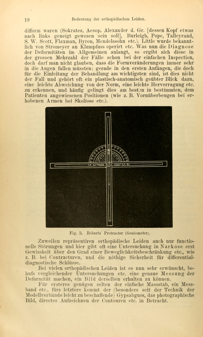 diffoim waren (Sokrates. Aesop, Alexander d. Gr. [dessen Kopf etwas nach links geneigt gewesen sein soll], Burleigh, Pope, Talleyrand, S. W. Scott, Flaxman, BjTon, Mendelssohn etc.). Little wurde bekannt- lich von Stromeyer an Klumpfuss operirt etc. Was nun die Diagnose der Deformitäten im Allgemeinen anlangt, so ergibt sich diese in der grossen Mehrzahl der Fälle schon bei der einfachen Inspection, doch darf man nicht glauben, dass die Formveränderungen immer sehr in die Augen fallen müssten; gerade in den ersten Anfängen, die doch für die Einleitung der Behandlung am wichtigsten sind, ist dies nicht der Fall und gehört oft ein plastisch-anatomisch geübter Blick dazu, eine leichte Abweichung von der Norm, eine leichte Hervorragung etc. zu erkennen, und häufig gelingt dies am bestan in bestimmten, dem Patienten angewiesenen Positionen (wie z. B. Vornüberbeugen bei er- hobenen Armen bei kSkoliose etc.). Fig. 3. Roberts' Protraetor ((ioniometer;. Zuweilen repräsentiren orthopädische Leiden auch nur functio- nelle Störungen und hier gibt oft eine Untersuchung in Narkose erst Gew'issheit über den Grad einer Beweglichkeitsbeschränkung etc., wie z. B. bei Contracturen, und die nöthige Sicherheit für differential- diagnostische Schlüsse. Bei vielen orthopädischen Leiden ist es nun sehr erwünscht, be- hufs vergleichender Untersuchungen etc. eine genaue Messung der Deformität machen, ein Bild derselben erhalten zu können. Für ersteres genügen selten der einfache Massstab, ein Mess- band etc. fürs letztere kommt der (besonders seit der Technik der Modellverbäude leicht zu beschaffende) Gypsabguss, das photographische Bild, directes Aufzeichnen der Contouren etc. in Betracht.