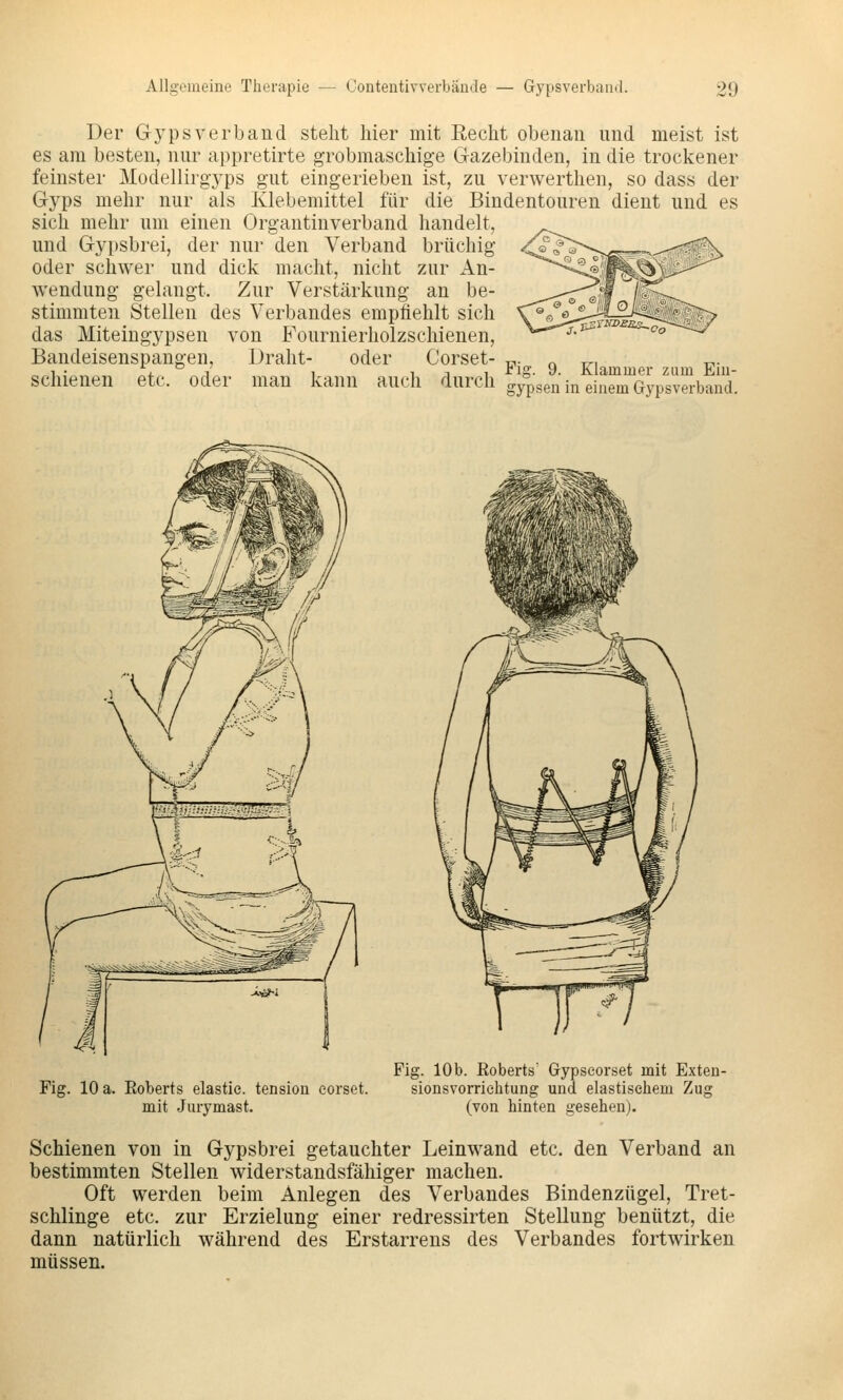 Der Gypsverband steht hier mit Recht obenan und meist ist es am besten, nur appretirte grobmaschige Gazebinden, in die trockener feinster Modellirgyps gut eingerieben ist, zu verwerthen, so dass der Gyps mehr nur als Klebemittel für die Bindentouren dient und es sich mehr um einen Organtinverband handelt, und Gypsbrei, der nur den Verband brüchig oder schwer und dick macht, nicht zur An- wendung gelangt. Zur Verstärkung an be- stimmten Stellen des Verbandes empfiehlt sich das Miteingypsen von Fournierholzschienen, Bandeisenspangen, Draht- oder Corset- u- o t^. t^- 1 ■ 4. ^ 1 111 ^ig- 9- Klammer zum Ein- schienen etc. oder man kann auch durch o-yp^en in einem Gypsverbind Fig. 10 a. Eoberts elastie. tension eorset. mit Jurymast. Fig. 10b. Eoberts' Gypscorset mit Exten- sionsvorrichtung und elastischem Zug (von hinten gesehen). Schienen von in Gypsbrei getauchter Leinwand etc. den Verband an bestimmten Stellen widerstandsfähiger machen. Oft werden beim Anlegen des Verbandes Bindenzügel, Tret- schlinge etc. zur Erzielung einer redressirten Stellung benützt, die dann natürlich während des Erstarrens des Verbandes fortwirken müssen.