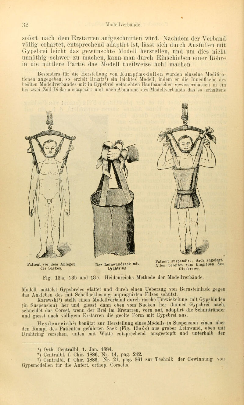 sofort nach dem Erstarren anfgeschnitten wird. Nachdem der Verband völlig erhärtet, entsprechend adaptirt ist, lässt sich durch Ausfüllen mit Gypsbrei leicht das gewünschte Modell herstellen, und um dies nicht unnöthig schwer zu machen, kann man durch Einschieben einer Röhre in die mittlere Partie das Modell theilweise hohl machen. Besonders für die Herstellung von Rumpfniodellen wurden einzelne Modifiea- tionen angegeben, so erzielt Braatz') ein leichtes Modell, indem er die Innenfläche des beölten Modellverbandes mit in G>psbrei getauchten Hanfbausehen gewissermassen in ein bis zwei Zoll Dicke austapezirt und nach Abnahme des Modellverbands das so erhaltene Patient vor dem Anlegen des Sackes. Der Leinwandsack mit Drahtring. Patient snspendirt, Sack angelegt. Alles bereitet zum Eingießen des Giosbreie? Fig. 13 a, 13b und 13 e. Heidenreiehs Methode der Modellverbände. Modell mittelst Gypsbreies glättet und durch einen Ueberzug von Bernsteinlaek gegen das Ankleben des mit Schellacklösung imprägnirten Filzes schützt. Karewski') stellt einen Modellverband durch rasche Umwickelung mit Gypsbinden (in Suspension) her und giesst dann oben vom ISaeken her dünnen (j>j)sbrei nach, sehneidet das Corset, wenn der Brei im Erstarren, vorn auf, adaptirt die Schnittränder und giesst nach völligem Erstarren die geölte Form mit Gypsbrei aus. Heydenreieh^) benützt zur Herstellung eines Modells in Suspension einen über den Rumpf des Patienten geführten Sack (Fig. 13a 6c) aus grober Leinwand, oben mit Drahtring versehen, unten mit Watte entsprechend ausgestopft und unterhalb der 1) Orth. Centralbl. 1. Jan. 1884. 2) Centralbl. f. Chir. 1886, Nr. 14, pag. 242. 3) Centralbl. f. Chir. 1886, Nr. 21, pag. 361 zur Technik der Gewinnung von Gypsmodellen für die Anfert. orthop. Corsetts.