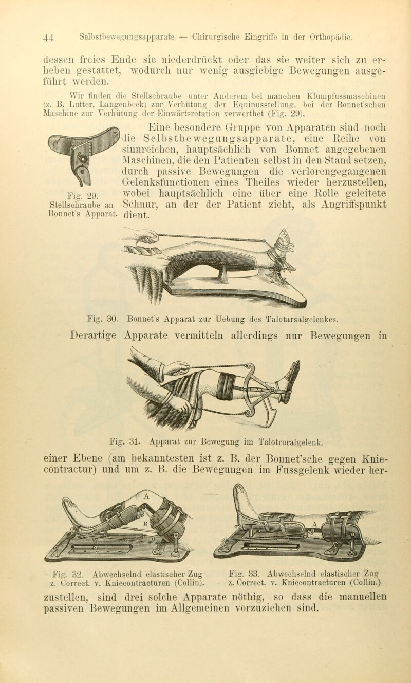 dessen freies Ende sie niederdrückt oder das sie weiter sich zn er- heben gestattet, wodurch nur wenig ausgiebige Bewegungen ausge- führt werden. Wir finden die Stellsehraube unter Anderem bei manchen Klumpfussmasehinen (z. B. Lutter, Langenboek) zur Verhütung der Equinusstellung, bei der Bonnetsehen Maschine zur Verhütung der Eiuwärtsrotation verwertliet (Fig. 29). Eine besondere Gruppe von Apparaten sind noch die Selbstbewegungsapparate, eine Reihe von sinnreichen, hauptsächlich von Bonnet angegebenen Maschinen, die den Patienten selbst in den Stand setzen, durch passive Bewegungen die verlorengegangenen Grelenksfunctiouen eines Theiles wieder herzustellen, Fig. 29. wobei hauptsächlich eine über eine Eolle geleitete Stellsehraube an Schnur, au der der Patient zieht, als Augritfspunkt Bonnet's Apparat, dient. Fig. 30. Bonnets Apparat zur Uebung des Talotarsalgelenkes. Derartige Apparate vermitteln allerdings nur Bewegungen in Fig. 31. Apparat zur Bewegung im Talotruralgelenk. einer Ebene Tarn bekanntesten ist z. B. der Bonuet'sche gegen Knie- contractur) und um z. B. die Bewegungen im Fussgelenk wieder her- Fig. 32. Abwechselnd elastischer Zug Fig. 33. Abwechselnd elastischer Zug z. Correet. v. Knieeontraeturen (Collin). z. Correct. v. Kniecontraeturen (CoUin.) zustellen, sind drei solche Apparate uöthig, so dass die manuellen passiven Bewegungen im Allgemeinen vorzuziehen sind.