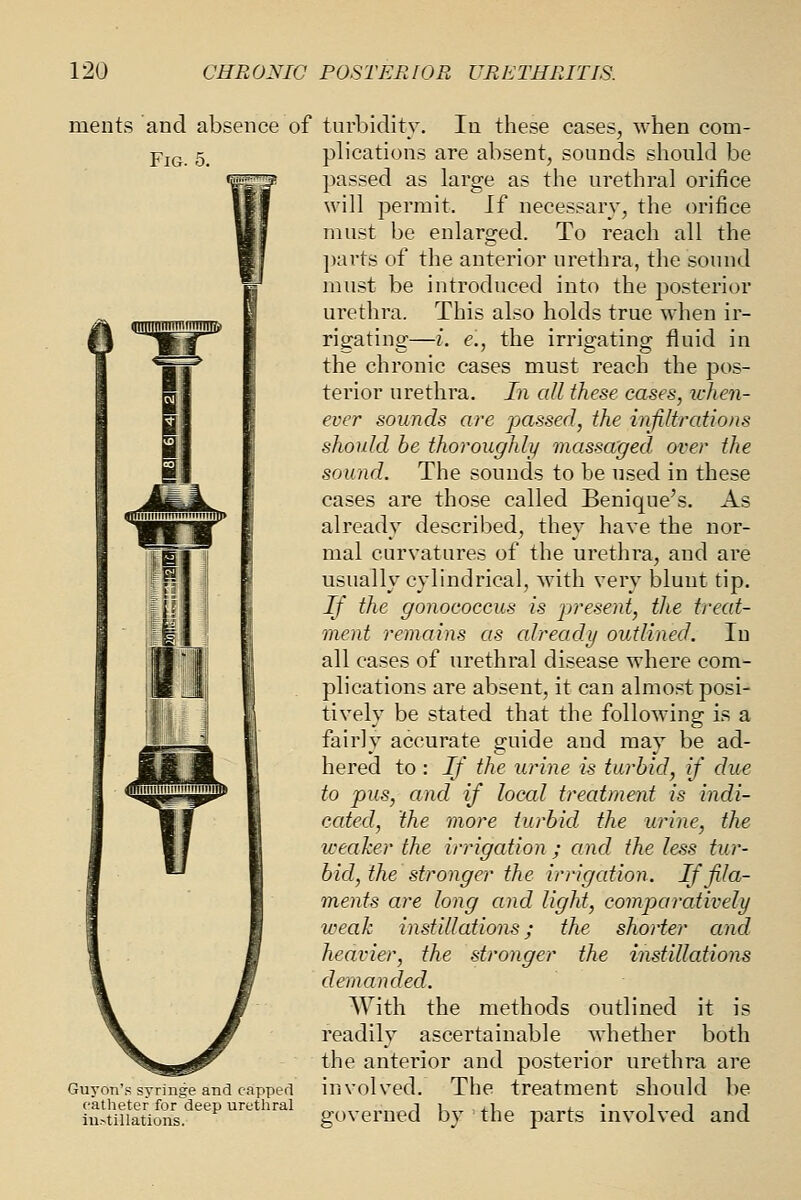 ments and absence of tnrbidity. In these cases, when com- YiQ, 5. plications are absent, sounds shonld be passed as large as the urethral orifice will permit. If necessary, the orifice must be enlarged. To reach all the parts of the anterior urethra, the sound must be introduced into the posterior urethra. This also holds true when ir- rigating—i. e., the irrigating fluid in the chronic cases must reach the pos- terior urethra. In all these cases, tchen- ever sounds are passed, the injiltrcdions should he thoroughly massaged over the sound. The sounds to be used in these cases are those called Benique's. As already described, they have the nor- mal curvatures of the urethra, and are usually cylindrical, Avith very blunt tip. If the gonococcus is present, the treat- ment remains as already outlined. In all cases of urethral disease where com- plications are absent, it can almost posi- tively be stated that the following is a fairly accurate guide and may be ad- hered to : If the urine is turbid, if due to pus, and if local treatment is indi- cated, the more turbid the urine, the weaker the irrigation ; and the less tur- bid, the stronger the irrigation. If fila- ments are long and light, comparatively iveak instillations; the shorter and heavier, the stronger the instillations demanded. AVith the methods outlined it is readily ascertainable whether both the anterior and posterior urethra are Guyon's sTrinse and capped involved. The treatment should be hMtion.!''''''''''' governed by the parts involved and