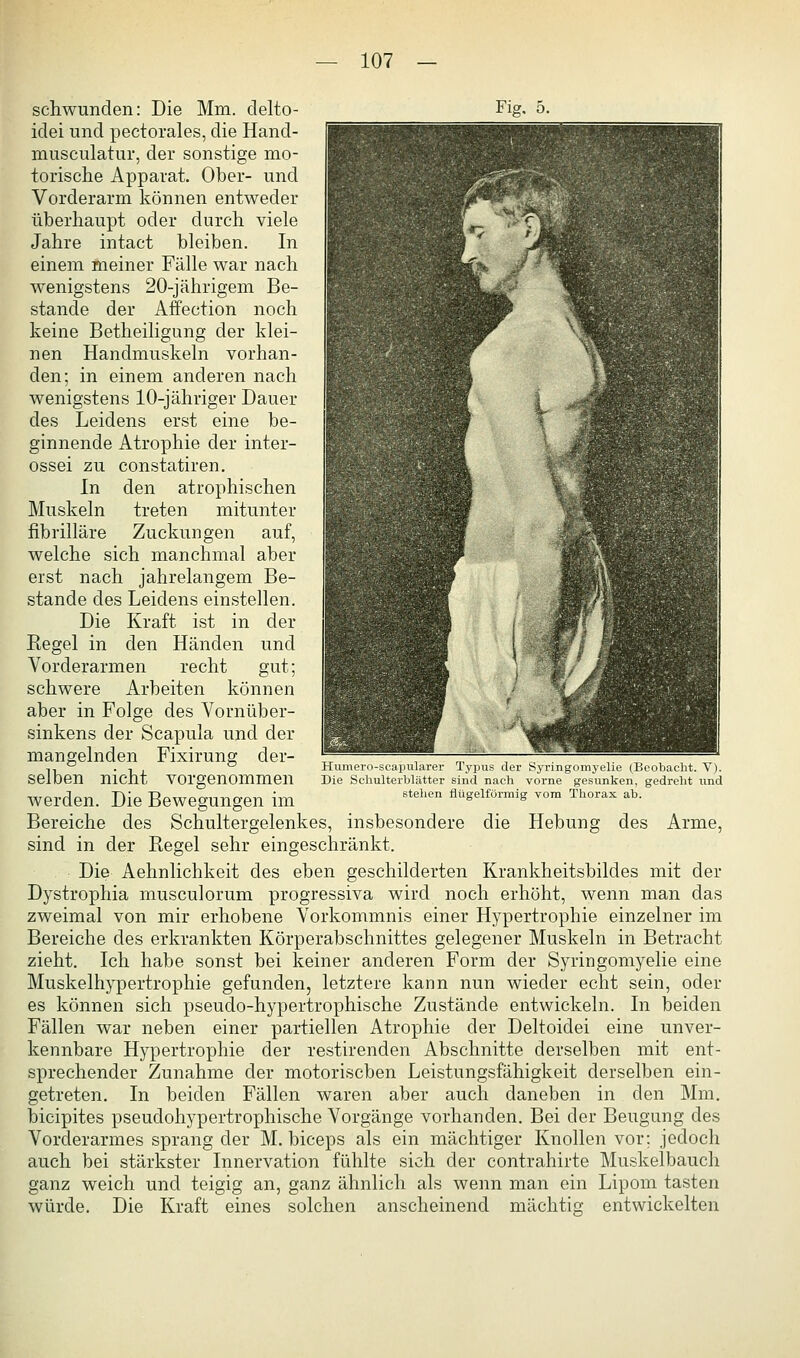 schwunden: Die Mm. clelto- idei und pectorales, die Hand- musculatur, der sonstige mo- torische Apparat. Ober- und Vorderarm können entweder überhaupt oder durch viele Jahre intact bleiben. In einem meiner Fälle war nach wenigstens 20-jährigem Be- stände der Affection noch keine Betheiligung der klei- nen Handmuskeln vorhan- den; in einem anderen nach wenigstens 10-jähriger Dauer des Leidens erst eine be- ginnende Atrophie der inter- ossei zu constatiren. In den atrophischen Muskeln treten mitunter fibrilläre Zuckungen auf, welche sich manchmal aber erst nach jahrelangem Be- stände des Leidens einstellen. Die Kraft ist in der Kegel in den Händen und Vorderarmen recht gut; schwere Arbeiten können aber in Folge des Vornüber- sinkens der Scapula und der mangelnden Fixirung der- selben nicht vorgenommen werden. Die Bewegungen im Bereiche des Schultergelenkes, insbesondere die Hebung des Arme, sind in der Regel sehr eingeschränkt. Die Aehnlichkeit des eben geschilderten Krankheitsbildes mit der Dystrophia musculorum progressiva wird noch erhöht, wenn man das zweimal von mir erhobene Vorkommnis einer Hypertrophie einzelner im Bereiche des erkrankten Körperabschnittes gelegener Muskeln in Betracht zieht. Ich habe sonst bei keiner anderen Form der Syringomyelie eine Muskelhypertrophie gefunden, letztere kann nun wieder echt sein, oder es können sich pseudo-hypertrophische Zustände entwickeln. In beiden Fällen war neben einer partiellen Atrophie der Deltoidei eine unver- kennbare Hypertrophie der restirenden Abschnitte derselben mit ent- sprechender Zunahme der motorischen Leistungsfähigkeit derselben ein- getreten. In beiden Fällen waren aber auch daneben in den Mm. bicipites pseudohypertrophische Vorgänge vorhanden. Bei der Beugung des Vorderarmes sprang der M. biceps als ein mächtiger Knollen vor; jedoch auch bei stärkster Innervation fühlte sich der contrahirte Muskelbauch ganz weich und teigig an, ganz ähnlich als wenn man ein Lipom tasten würde. Die Kraft eines solchen anscheinend mächtig entwickelten Humero-scapularer Typus der Syringomyelie (Beobacht. V). Die Schulterblätter sind nach vorne gesunken, gedreht und stellen flügeiförmig vom Thorax ab.