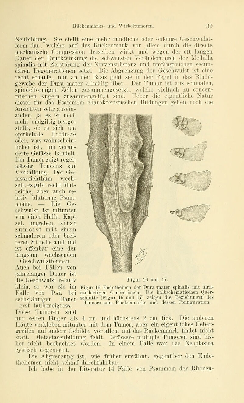Neubildung. Sie stellt eine melir nnulliclie oder oblonge Geschwulst- form dar, welche auf das Eiickenniark vor allem durch die direete mechanische Compression desselben wirkt und weg-en der oft langen Dauer der Druckwirkung die schwersten Veränderungen der Medulla spinalis mit Zerstörung der Nervensubstanz und umfangreichen secun- dären Degenerationen setzt. Die Abgrenzung der Gesch^iilst ist eine recht scharfe, nur an der Basis geht sie in der Regel in das Binde- gewebe der Dura mater allmälig über. Der Tumor ist aus schmalen, spindelförmigen Zellen zusammengesetzt, welche vielfach zu concen- trischen Kugeln znsammengcfiliiT sind. Felier die eigentliche Natur dieser für das Psammom rharakteristischen Bildungen gehen noch die Ansichten sehr ausein- ander, ja es ist noch tBteMitilai'-; .^/.«.Ü^b^. -t-j,,^ nicht endgiltig festge- B^hSIS '  ^^ i^'T' stellt, ob es sich um «^■i'j* Ä ~*. epitheliale Producte oder, was wahrschein- licher ist, um verän- derte Gefässe handelt. Der Tumor zeigt regel- mässig Tendenz zur Verkalkung. Der Ge- fässreichthum wech- selt, es gibt recht blut- reiche, aber auch re- lativ blutarme Psam- mome. — Die Ge- schwulst ist mitunter von einer Hülle. Kap- sel , umgeben. sitzt zumeist mit einem schmäleren oder brei- teren Stieleauf und ist oifenbar eine der langsam wachsenden Geschwnlstformen. Auch bei F'ällen von jahrelanger Dauer ist die Geschwulst relativ Figur 16 und 17. klein, so war sie im Figur 16 Endotlieliom der Dura 'inater spinalis mit liii'n- Falle von Pal bei sandartigen Concretionen. Die halbscliematischen Quer- sechsiähriger Dauer schnitte (Figur 16 und 17) zeigen die Beziehungen des ' r . Tumors zum Euckenniarke und dessen Coniiguration. erst taubeneigross. Diese Tumoren sind niu' selten länger als 4 cm und höchstens 2 cm dick. Die anderen Häute verkleben mitunter mit dem Tumor, aber ein eigentliches Ueber- greifen auf andere Gebilde, vor allem auf das Rückenmark findet nicht statt. Metastaseubildung fehlt. Grössere multiple Tumoren sind bis- her nicht beobachtet worden. In einem Falle war das Neoplasma cystisch degenerirt. Die Abgrenzung ist, wie früher erwähnt, gegenüber den Endo- theliomen nicht scharf durchführbar. Ich hal)e in der Literatur 14 Fälle von Psammom der Rücken- y