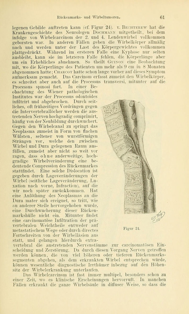 legenen Gebilde auftreten kann (cf. Figur 24). v. Bechterew hat die Krankengeschichte des Neurologen Dochjiakn mitg-etheilt, bei dem infolge von Wirbelcarcinom der 2. und 4. Lendenwirbel vollkommen geborsten war. In anderen Fällen geben die Wirbelkörper allmälig nach und werden unter der Last des Körpergewichtes vollkommen plattgedrückt. Während im ersteren Falle eine Kj-phose nur selten ausbleibt, kann sie im letzteren Falle fehlen, die Körperlänge aber um ein Erhebliches abnehmen. So theilt Guinon eine Beobachtung mit, wo die Körperlänge des Patienteu um mehr als 9 cm in 8 Monaten abgenommen hatte; Chajrcot hatte schon lange vorher auf dieses Symptom aufmerksam gemacht. Das Carcinom erfasst zumeist den Wirbelkörper, es schreitet aber auch auf die Processus transversi, mitunter auf die Processus spinosi fort. In einer Be- obachtung des Wiener pathologischen Institutes war der Processus odontoides infiltrirt und abgebrochen. Durch seit- liches, oft frühzeitiges Vordringen gegen die Intervertebrallöcher werden die aus- tretenden Nerven hochgradig comprimirt, häufig von der Neubildung durchwuchert. Gegen den Wirbelcanal zu springt das Neoplasma zumeist in Form von flachen Wülsten, seltener von wurstförmigen Strängen vor, welche den zwischen Wirbel und Dura gelegenen Eaum aus- füllen, zumeist aber nicht so weit vor ragen, dass ohne anderweitige, hoch- gradige Wirbelveränderung eine be- deutende Compression des Eückenmarkes stattfindet. Eine solche Dislocation ist gegeben durch Lageveränderungen der Wirbel (seitliche Lageveräuderung, Lu- xation nach vorne, Infraction), auf die wir noch später zurückkommen. Hat eine Anlöthung des Neoplasmas an die Dura mater sich ereignet, so tritt, wie an anderer Stelle hervorgehoben wurde, eine Durchwucherung dieser Eücken- markshülle nicht ein. Mitunter findet eine cai-cinomatöse Infiltration der prä- vertebralen Weichtheile entweder auf metastatischem Wege oder durch directes Fortschreiten von der Wirbelläsion aus statt, und gelangen hierdurch extra- vertebral die austretenden Nervenstämme zur carcinomatösen Ein- scheidung und Zerstörung. Da durch diesen Vorgang Nerven getroffen werden können, die von viel höheren oder tieferen Eückenmarks- segmenten abgehen, als dem erkrankten Wirbel entsprechen Avürde, können wesentliche diagnostische Irrthümer inbezug auf den Höhen- sitz der Wirbelerkrankung unterlaufen. Das Wirbelcarcinom ist fast immer multipel, besonders schon zu einer Zeit, wo es klinische Erscheinungen hervorruft. In manchen Fällen erkrankt die ganze Wirbelsäule in diffuser Weise, so dass die ,?1^^| Fie-nr 24.