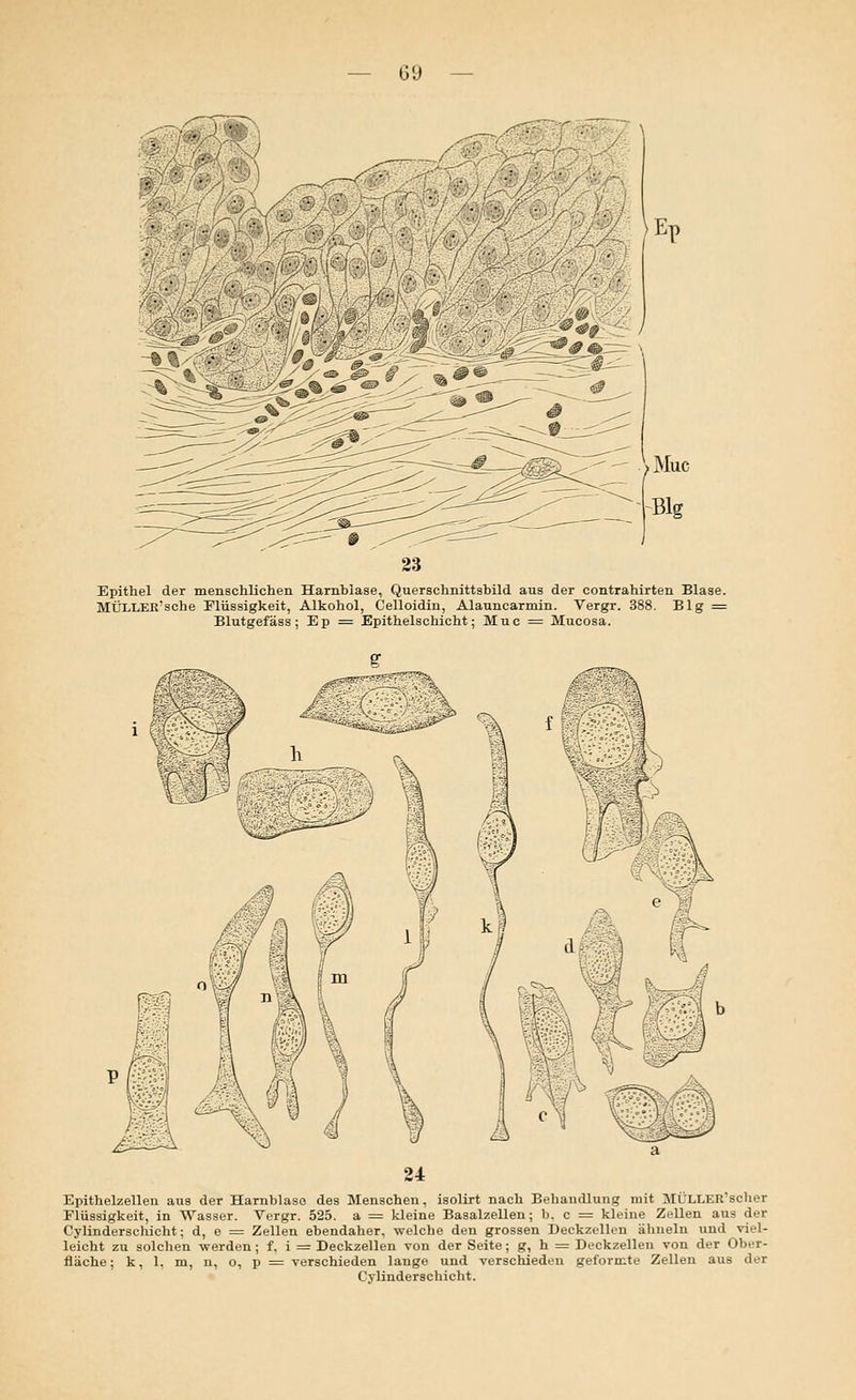 Muc Epithel der menschlichen Harnblase, Querschnittsbild aus der contrahirten Blase. MÜXLER'sche Flüssigkeit, Alkohol, Celloidin, Alauncarmin. Vergr. 388. Big = Blutgefäss; Ep = Epithelschicht; Muc = Mucosa. Epithelzellen aus der Harnblase des Menschen, isolirt nach Behandlung mit MÜLLER'scher Flüssigkeit, in Wasser. Vergr. 525. a = kleine Basalzellen; b, c = kleine Zellen aus der Cylinderscliicht; d, e = Zellen ebendaher, welche den grossen Deckzellen ähneln und viel- leicht zu solchen werden; f, i = Deckzellen von der Seite; g, h = Deckzellen von der Ober- fläche; k, 1. m, n, o, p = verschieden lange und verschieden geformte Zellen aus der Cylinderscliicht.