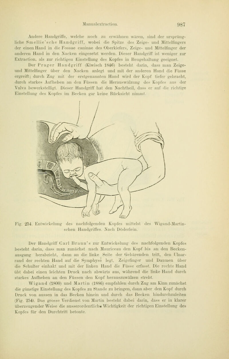 Andere Haiuli-'nn'e. welrlie iiorli /u eiuiilnieii wiueii. siinl <ler ursprüng- liche Sniellie'selie Handtrriff. wobei die Spitze des Zei^'e- uiul MiUelfiug'ers der einen Hand in die Fossae caninae des überliielers, Zeige- und Mittelfinger der anderen Hand in den Nacken eingesetzt werden. Dieser Handgriff ist weniger zur Extractinn, als zur richtigen Einstellung des Kopfes in Beugehaltung geeignet. Der Prager Handgriff (Kiwisch 1846) besteht darin, dass man Zeige- und Mitteltinger über den Nacken anlegt und mit der anderen Hand die Füsse ergreift; durch Zug mit der erstgenannten Hand wird der Kopf tiefer gebracht, durch starkes Aufheben an den Füssen die Herauswälzung des Kopfes aus der Vulva bewerkstelligt. Dieser Handgriff hat den Nachtheil, dass er auf die richtige Einstellung des Kopfes im Becken gar keine Rücksicht nimmt. Fi?. 254. Entwickelung des nachfolgenden Kopfes mittelst des Wigand-ilailin- schen Handirriffes. 2sach Döderlein. Der Handgriff Carl Braun's zur Entwckelung des nachfolgenden Kopfes besteht darin, dass man zunächst nach Mauriceau den Kopf bis an den Becken- ausgang herabzieht, dann an die linke Seite der Gebärenden tritt, den Ulnar- rand der rechten Hand auf die Symphyse legt, Zeigefinger und Daumen über die Schulter einhakt und mit der Hnken Hand die Füsse erfasst. Die rechte Hand übt dabei einen leichten Druck nach abwärts aus, ^vährend die linke Hand durch starkes Aufheben an den Füssen den Kopf herauszuwälzen strebt. Wigand (1800) und Martin (1886) empfahlen durch Zug am Kinn zunächst die günstige Einstellung des Kopfes zu Stande zu bringen, dann aber den Kopf dm-ch Druck von aussen in das Becken hinein und durch das Becken hindurchzuleiten (Fig. 254). Das grosse Verdienst von Martin besteht dabei darin, dass er in klarer überzeuo-ender Weise die ausserordentlich« Wichtigkeit der richtigen Einstellung des Kopfes für den Durchtritt betonte.
