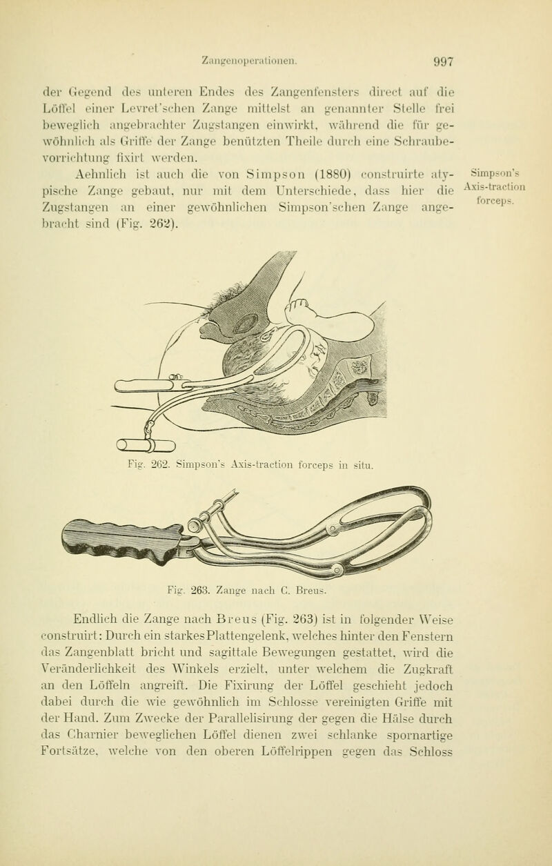 der Ciogeml des aatei-eii Endes des Zangenl'euslers diiect auf die Löü'el einer Levret'sehen Zange mittelst an genannter Stelle frei beweglich angebrachter Zugstangen einwirkt, wiihrend die für ge- wöhnlich als Griffe der Zange benützten Theile durch eine Schraube- vorrichtung llxiit werden. Aehnlich ist auch die von Simpson (1880) construirte aty- pische Zange gebaut, nur mit dem Unterschiede, dass hier die Zugstangen an einer gewöhnlichen Simpson'schen Zange ange- bracht sind (Fig. 262). Simpson's Axis-traction forceps. Fig. 262. Simpson's Axis-traction forceps in situ. Fig. 263. Zange nach C. Breus. Endlich die Zange nach Breus (Fig. 263) ist in folgender Weise construirt: Durch ein starkes Plattengelenk, welches hinter den Fenstern das Zangenblatt bricht und sagittale Bewegungen gestattet, wird die Veränderlichkeit des Winkels erzielt, unter welchem die Zugkraft an den Löffeln angreift. Die Fixirung der Löö'el geschieht jedoch dabei durch die wie gewöhnlich im Schlosse vereinigten Griö'e mit der Hand. Zum Zwecke der Parallelisirung der gegen die Hälse durch das Charnier beweglichen Löffel dienen zwei schlanke spornartige Fortsätze, welche von den oberen Löffelrippen gegen das Schloss