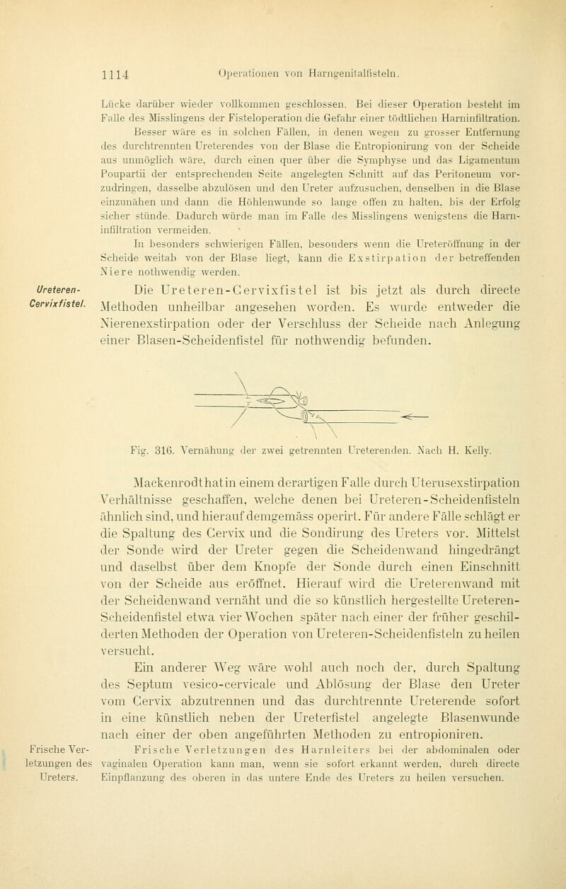 Ureteren- Cervixfistel. Lücke darüber wieder vollkommen geschlossen. Bei dieser Operation besteht im Falle des IVIisshngens der Fisteloperation die Gefahr- einer tödtlichen Harninfiltration. Besser wäre es in solchen Fällen, in denen wegen zu grosser Entfernung des durchtrennten Ureterendes von der Blase die Entropionii'ung von der Scheide aus unmöglich wäre, durch einen quer über die Symphyse und das Ligamentum Poupartii der entsprechenden Seite angelegten Schnitt auf das Peritoneum vor- zudringen, dasselbe abzulösen und den Ureter aufzusuchen, denselben in die Blase einzunähen und dann die Höhlenwunde so lange offen zu halten, bis der Erfolg sicher stünde. Dadurch wäirde man im Falle des Misshngens wenigstens die Harn- infiltration vermeiden. In besonders schwierigen Fällen, besonders wenn die Ureteröfifnung in der Scheide weitab von der Blase liegt, kann die Exstirpation der betreffenden Niere nothwendig werden. Die Ureteren-Cervixfistel ist bis jetzt als durch directe Methoden unheilbar angesehen worden. Es wurde entweder die Nierenexstirpation oder der Verschluss der Scheide nach Anlegung einer Blasen-Scheidenfistel für nothwendig' befunden. Fiff. 316. Vernähung der zwei getrennten Ureterenden. Nach H. Kellv. Mackenrodthatin einem derartigen Falle durch üterusexstirpation Verhältnisse geschaffen, welche denen bei Ureteren-Scheidenfisteln ähnlich sind, und hierauf demgemäss operirt. Für andere Fälle schlägt er die Spaltung des Cervix und die Sondirung des Ureters vor. Mittelst der Sonde wird der Ureter gegen die Scheidenwand hingedrängt und daselbst über dem Knopfe der Sonde durch einen Einschnitt von der Scheide aus eröffnet. Hierauf wird die Ureterenwand mit der Scheidenwand vernäht und die so künstlich hergestellte Ureteren- Scheidenfistel etwa vier Wochen später nach einer der früher geschil- derten Methoden der Operation von Ureteren-Scheidenfisteln zu heilen versucht. Ein anderer Weg wäre wohl auch noch der, durch Spaltung des Septum vesico-cervicale und Ablösung der Blase den Ureter vom Cervix abzutrennen und das durchtrennte Ureterende sofort in eine künstlich neben der Ureterfistel angelegte Blasenwunde nach einer der oben angeführten Methoden zu entropioniren. Frische Ver- Frische Verletzungen des Harnleiters bei der abdominalen oder letzungen des vaginalen Oj^eration kann man, wenn sie sofort erkannt werden, durch directe Ureters. Einpflanzung des oberen in das untere Ende des Ureters zu heilen versuchen.
