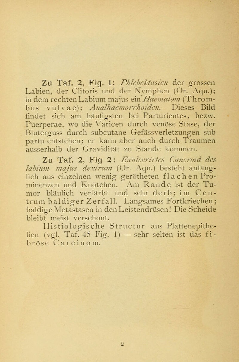 Zu Taf. 2, Fig. 1: Phlebektasien der grossen Labien, der Clitoris und der Nymphen (Or. Aqu.); in dem rechtenLabium majus ein Haematom (Throm- bus vulvae): Analhaemorrhoiden. Dieses Bild findet sich am häufigsten bei Parturientes, bezw. Pueiperae, wo die A'aricen durch venöse Stase. der Bluterguss durch subcutane Gefässverletzungen sub partu entstehen: er kann aber auch durch Traumen ausserhalb der Gravidität zu Stande kommen. Zu Taf. 2. Fig 2: Exidcerirtes Cancroid des labium majus dextrum (Or. Aqu.) besteht anfäng- lich aus einzelnen wenig gerötheten flachen Pro- muienzen und Knötchen. Am Rande ist der Tu- mor bläulich verfärbt und sehr derb: im Cen- trum baldiger Zerfall. Langsames Fortkriechen; baldige Metastasen in den Leistendrüsen I Die Scheide bleibt meist verschont. Histiologische Structur aus Plattenepithe- lien (vgl. Taf. 45 Fig. 1) — sehr selten ist das fi- bröse Ca reinem.
