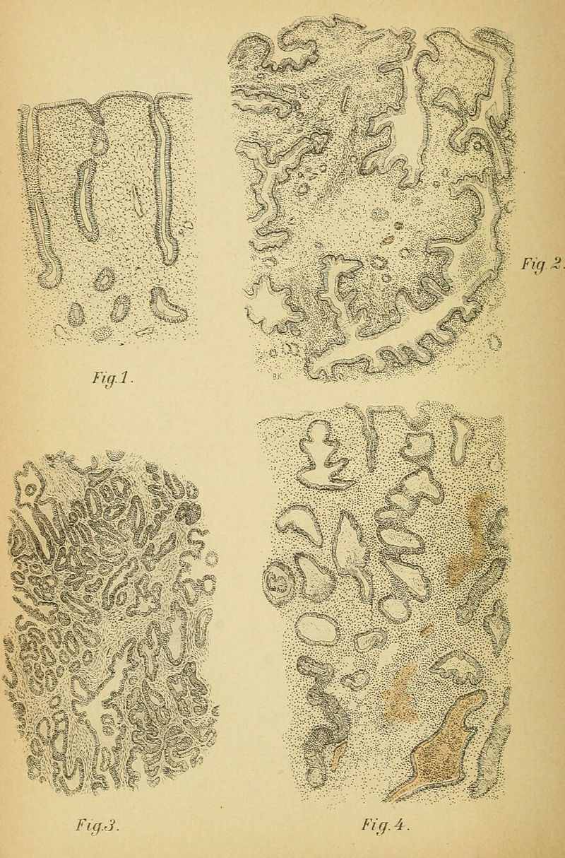 mm^ nMm Fiq ■0^ Tig.l. :^^Sp^' ;■•:'■-'■. 8X. ■•'^^iS ^§S$^ ^ % f. Ä §iJ^;v .^J%^^''^^yj%_.W'i5^ •^•.■.••■^•.^:^•.v.^,i■fe:i..«;v.„«(»;: 11^ 'W0!00^ V> 11%* /^.^.J?. Fjff.4-.