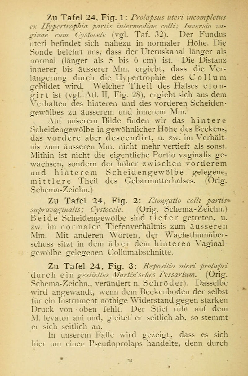ex Hvpertrop/iia parris iatermediae colli: Inversio va- •^inae cum Cystocele (vgl. Tat. o2). Der Fundus uteri befindet sich nahezu in normaler Höhe. Die Sonde belehrt uns. dass der Uteruskanal länger als normal (länger als 5 bis 6 cm) ist. Die Distanz innerer bis äusserer ^Im. ergiebt. da>s die \'er- längerung durch die Hvpertrophie des Collum o-ebildet w-ird. Welcher Theil des Halses elon- ofirt ist (vgl. Atl. ü, Fig. 28), ergiebt sich aus dem \'erhalten des hinteren und des vorderen Scheiden- ofewölbes zu äusserem und innerem Mm. Auf unserem Bilde finden wir das hintere Scheidengewölbe in gewöhnlicher Höhe des Beckens, das vordere aber descendirt. u. zw. im \'erhält- nis zum äusseren ]Mm. nicht mehr vertieft als sonst. Mithin ist nicht die eigentliche Portio vaginalis ge- wachsen, sondern der höher zwischen vorderem und hinterem Scheidengewölbe gelegene, mittlere Theil des Gebärmutterhalses. (Orig. Schema-Zeichn.) Zu Tafel 24, Fig. 2: Elongatio colli pai-tis^ supraz-aginalis; Cystocele. (Orig. Schema-Zeichn.) Beide Scheidengewölbe sind tiefer getreten, u. zw. im normalen Tiefenverhältnis zum äusseren Mm. Mit anderen Worten, der Waclisthumüber- schuss sitzt in dem über dem hinteren \'aginal- gewölbe gelegenen Collumabschnitte. Zu Tafel 24, Fig. 3: Repositio läeri prolapsi durch ein gestieltes Martin sches Pessariu/ji. (Orig. Schema-Zeichn., verän4ert n. Schröder). Dasselbe wird angewandt, wenn dem Beckenboden der selbst für ein Instrument nötliige Widerstand gegen starken Druck von • oben fehlt. Der Stiel ruht auf dem M. levator ani und, gleitet er seitlich ab. so stemmt er sich seitlich an. In unserem Falle wird p-ezei^ft. dass es sich hier um einen Pseudoprolaps handelte, denn durch