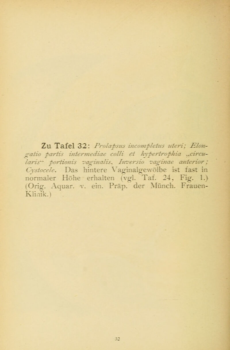 Zu Tafel 32: Prolapsus üicotnpletus uteri: Eloii- gaiio pariis iiüermediae colli et hyperirophia ^^circu- laris poriionis •vaginalis. Iirversio i^aginae anterior; Cystocele. Das hintere Vaginalgewölbe ist fast in normaler Höhe erhalten (vgl. Tat. 24, Fig. 1.) (Orig. Aquar. v. ein. Präp. der Münch. Frauen- Klinik.)
