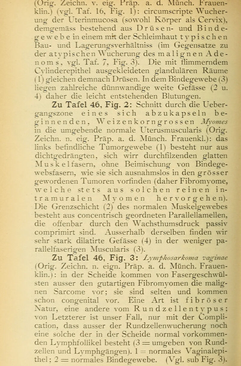 „ . \j ^ V. eig. rräp. a. d. Müach. rrauen- s.-- .. • _.. i\i:. 16. Fig. 1): circmnscripte Wucher- ung der L terimiiucosa (sowohl Körper als Cer\-ix), demgemäss bestehend aus Drüsen- und Binde- g e w e b e in einem nik der Schleimhaut typischen Bau- und Lagerungsverhältniss (im Gegensätze zu der atypischen AA ucherung des malignen Ade- noms, vgl. Taf. 7. Fig. 3). Die mit tiimmemdem Cvlinderepithel ausgekleideten glandulären Räume (1) gleichen demnach Drüsen. In dem Bindegewebe (3) liegen zahlreiche dünnwandige weite Gefässe (2 u. 4) daher die leicht entstehenden Blutungen. Zu Tafel 46. Fig. 2: Schnitt durch die Ueber- gangszone eines sich abzukapseln be- ginnenden. AA eizenkorngrossen Myomes in die umsfebende normale Uterusmuscularis (Orio-. Zeichn. n. eig. Präp. a. d. ]Münch. Frauenkl.): das links befindliche Tumorgewebe (1) besteht nur aus dichtgedrängten, sich wirr durchfilzenden glatten ^I u s k e 1 fasern, ohne Beimischung von Bindege- websfasern, wie sie sich ausnahmslos in den grösser gewordenen Tumoren vorfinden (daher Fibromvome, welche stets aus solchen reinen in- tramuralen ]Mvomen hervorgehen). Die Grenzschicht (2) des normalen ^Muskelgewebes besteht aus concentrisch g-eordneten Parallellamellen. die offenbar durch den Wachsthumsdruck passiv comprimirt sind. Ausserhalb derselben finden vAx sehr stark dilatirte Gefässe (4j in der weniger pa- rallelfaserigen ]Muscularis (3j. Zu Tafel 46, Fig. 3: Lvinphosarkoma vaginae (Orig. Zeichn. n. eign. Präp. a. d. Münch. Frauen- klin.j: in der Scheide kommen von Fasergeschwül- sten ausser den gutartigen Fibromvomen die mahg- nen Sarcome vor; sie sind selten und kommen schon congenital vor. Eine Art ist fibröser Natur, eine andere vom Rundzellent\'pus; von Letzterer ist unser Fall, nur mit der Compli- cation, dass ausser der Rundzellenwnicherung noch eine solche der in der Scheide normal vorkommen- den Lvmphfollikel besteht (3 = umgeben von Rund- zellen und Lvmphgängenj. 1 — normales Vaginalepi- thel : 2 = normales Bindegewebe. (Vgl. sub Fig. 3j.