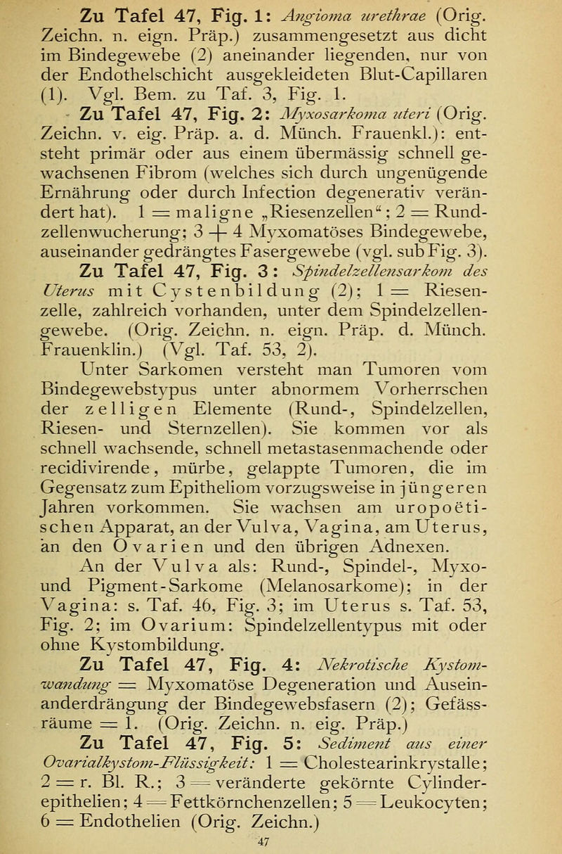 Zeichn. n. eign. Präp.j zusammengesetzt aus dicht im Bindegewebe (2) aneinander liegenden, nur von der Endothelschicht ausgekleideten Blut-Capillaren (1). Vgl. Rem. zu Taf. 3, Fig. 1. Zu Tafel 47, Fig. 2: Afyxosarkoma uteri (Orig. Zeichn. v. eig. Präp. a. d. Münch. Frauenkl.): ent- steht primär oder aus einem übermässig schnell ge- wachsenen Fibrom (welches sich durch ungenügende Ernährung oder durch Infection degenerativ verän- dert hat). 1 ^ maligne „Riesenzellen; 2 = Rund- zellenwucherung; 3 -|- 4 Myxomatöses Bindegewebe, auseinander gedrängtes Fasergewebe (vgl. subFig. 3). Zu Tafel 47, Fig. 3 : Spindelzellensarkom des Uterus mit Cystenbildung (2); 1= Riesen- zelle, zahlreich vorhanden, unter dem Spindelzellen- gewebe. (Orig. Zeichn. n. eign. Präp. d. Münch. Frauenkhn.) (Vgl. Taf. 53, 2). Unter Sarkomen versteht man Tumoren vom Bindegewebstypus unter abnormem Vorherrschen der zelligen Elemente (Rund-, Spindelzellen, Riesen- und Sternzellen). Sie kommen vor als schnell wachsende, schnell metastasenmachende oder recidivirende, mürbe, gelappte Tumoren, die im Gegensatz zum Epitheliom vorzugsweise in jüngeren Jahren vorkommen. Sie wachsen am uropoeti- schen Apparat, an der Vulva, Vagina, am Uterus, an den Ovarien und den übrigen Adnexen. An der Vulva als: Rund-, Spindel-, Myxo- und Pigment-Sarkome (Melanosarkome); in der Vagina: s. Taf. 46, Fig. 3; im Uterus s. Taf. 53, Fig. 2; im Ovarium: Spindelzellentypus mit oder ohne Kystombildung. Zu Tafel 47, Fig. 4: Nekrotische Kystom- wandimg = Myxomatöse Degeneration und Ausein- anderdrängung der Bindegewebsfasern (2); Gefäss- räume = 1. (Orig. Zeichn. n. eig. Präp.j Zu Tafel 47, Fig. 5: Sediment aus einer Ovarialkystom-Flüssigkeit: 1 = Cholestearinkrystalle; 2 = r. Bl. R.; 3 = veränderte gekörnte Cylinder- epithelien; 4^Fettkörnchenzellen; 5 = Leukocyten; 6 = Endothehen (Orig. Zeichn.) 47