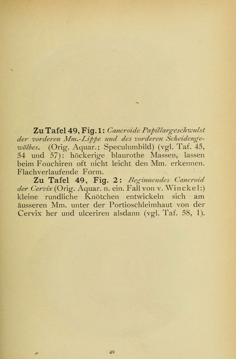 der vorderen JMm.-JLtppe u?id des vordereti Scheidenge- ivölbes. (Orig. Aquar.; Speculumbild) (vgl. Taf. 45, 54 und 57): höckerige blaurothe Massen, lassen beim Foüchiren oft nicht leicht den Mm. erkennen. Flachverlaufende Form. Zu Tafel 49, Fig. 2: Begmuendes Cancroid der Cervix (Orig. Aquar. n. ein. Fall von v. Win ekel:) kleine rundliche Knötchen entwickeln sich am äusseren Mm. unter der Portioschleimhaut von der Cervix her und ulceriren alsdann (vgl. Taf. 58, 1). 49