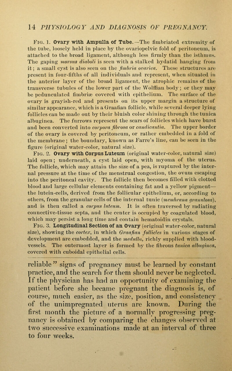 Fig. 1. Ovary with Ampulla of Tube.—The fimbriated extremity of the tube, loosely held iu place by the ovariopelvic fold of peritoneum, is attached to the broad ligament, although less firmly than the isthmus. The gaping morsus diahoU is seen with a stalked hydatid hanging from it; a small cyst is also seen on the fimbria ovarica. These structures are present in four-fifths of all individuals and represent, when situated in the anterior layer of the broad ligament, the atrophic remains of the transverse tubules of the lower part of the Wolffian body; or they may be pedunculated fimbriae covered with epithelium. The surface of the ovary is grayish-red and presents on its upper margin a structure of similar appearance, which is a Graafian follicle, while several deeper lying follicles can be made out by their bluish color shining through the tunica albuginea. The furrows represent the scars of follicles which have burst and been converted into corpora fibrosa or candicantia. The upper border of the ovary is covered by peritoneum, or rather embedded in a fold of the membrane; the boundary, known as Farre's line, can be seen in the figure (original water-color, natural size). Fig. 2. Ovary with Corpus Luteum (original water-color, natural size) laid open; underneath, a cyst laid open, with myoma of the uterus. The follicle, which may attain the size of a pea, is ruptured by the inter- nal pressure at the time of the menstrual congestion, the ovum escaping into the peritoneal cavity. The follicle then becomes filled with clotted blood and large cellular elements containing fat and a yellow pigment— the lutein-cells, derived from the follicular epithelium, or, according to others, from the granular cells of the internal tunic {membrana granulosa), and is then called a corpus luteum. It is often traversed by radiating connective-tissue septa, and the center is occupied by coagulated blood, which may persist a long time and contain hematoidin crystals. Fig. 3. Longitudinal Section of an Ovary (original water-color, natural size), showing the cortcr., in which Graafian follicles in various stages of development are embedded, and the medulla., richly supplied with blood- vessels. The outermost laj^er is formed by the fibrous tunica albuginea, covered with cuboidal epithelial cells. reliable sig-ns of pregnancy must be learned by constant practice, and the search for them should never be neglected. If the physician has had an opportunity of examining the patient before she became ])regnant the diagnosis is, of course, much easier, as the size, position, and consistency of the unimpregnated uterus are known. During the first month the picture of a normally progressing preg- nancy is obtained by comparing the changes observed at two successive examinations made at an interval of three to four weeks.
