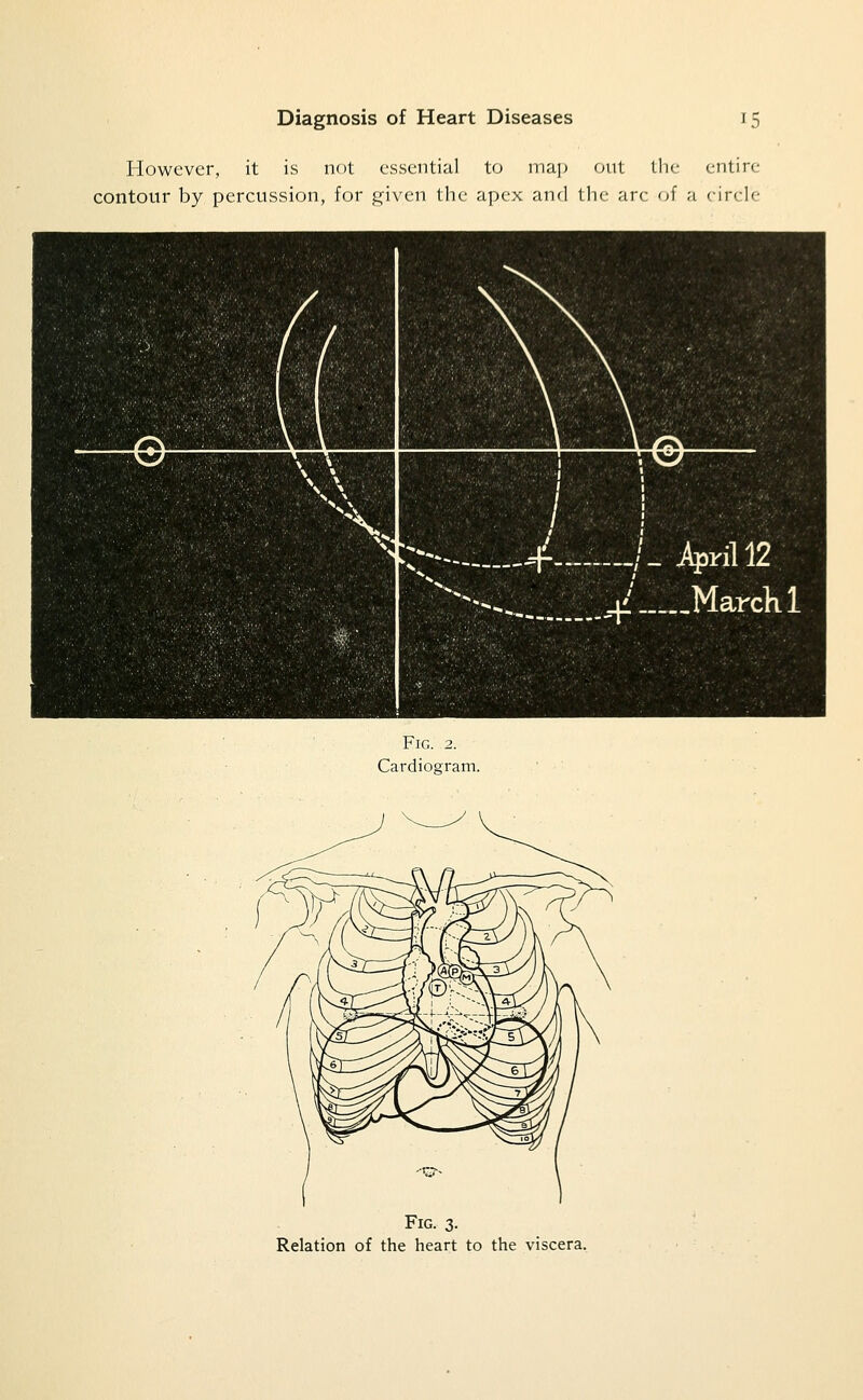 However, it is not essential to map out the entire contour by percussion, for j:;^ivcn the apex and the arc of a circle r;^^^^^^^ X^ \ A /r\ ^^ ^ 1 i ■■ ■ ■■'.-..■ ,■'■., ■■;■ ■ :, :!??, . . ■ :;:--.„.^^--J-Vill2 '^--,.,..._ _...^i' March 1 Fig. 2. Cardiogram. Fig. 3- Relation of the heart to the viscera.