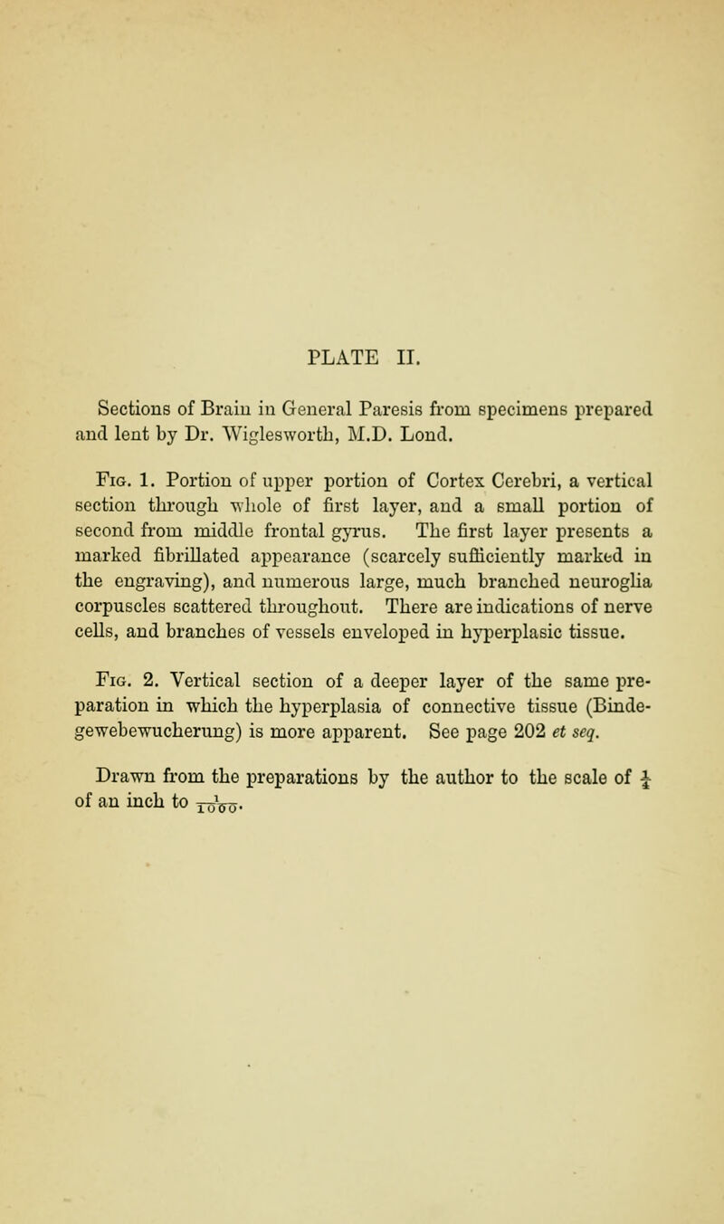 Sections of Braiu in General Paresis from specimens prepared and lent by Dr. Wigleswortb, M.D. Lond. Fig. 1. Portion of upper portion of Cortex Cerebri, a vertical section tbi'ougb ■v\liole of first layer, and a small portion of second from middle frontal gyrus. Tbe first layer presents a marked fibrillated appearance (scarcely sufiiciently marked in tbe engraving), and numerous large, mucb brancbed neuroglia corpuscles scattered tkrougbout. Tbere are indications of nerve cells, and brancbes of vessels enveloped in byperplasic tissue. Fig. 2. Vertical section of a deeper layer of tbe same pre- paration in wbicb tbe byperplasia of connective tissue (Binde- gewebewucberuug) is more apparent. See page 202 et seq. Drawn from tbe preparations by tbe autbor to tbe scale of ^ of an incb to xoVo.