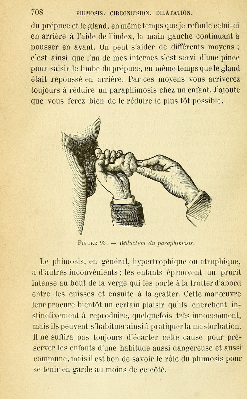 du prépuce et le gland, en même temps que je refoule celui-ci en arrière à l'aide de l'index, la main gauche continuant à pousser en avant. On peut s'aider de différents moyens ; c'est ainsi que l'un de mes internes s'est servi d'une pince pour saisir le limbe du prépuce, en même temps que le gland était repoussé en arrière. Par ces moyens vous arriverez toujours à réduire un paraphimosis chez un enfant. J'ajoute que vous ferez bien de le réduire le plus tôt possible. Figure 93. — Réduction du paraphimosis. Le phimosis, en général, hypertrophique ou atrophique, a d'autres inconvénients ; les enfants éprouvent un prurit intense au bout de la verge qui les porte à la frotter d'abord entre les cuisses et ensuite à la gratter. Cette manœuvre leur procure bientôt un certain plaisir qu'ils cherchent in- stinctivement à reproduire, quelquefois très innocemment, mais ils peuvent s'habituer ainsi à pratiquer la masturbation. Il ne suffira pas toujours d'écarter cette cause pour pré- server les enfants d'une habitude aussi dangereuse et aussi commune, mais il est bon de savoir le rôle du phimosis pour se tenir en garde au moins de ce côté.