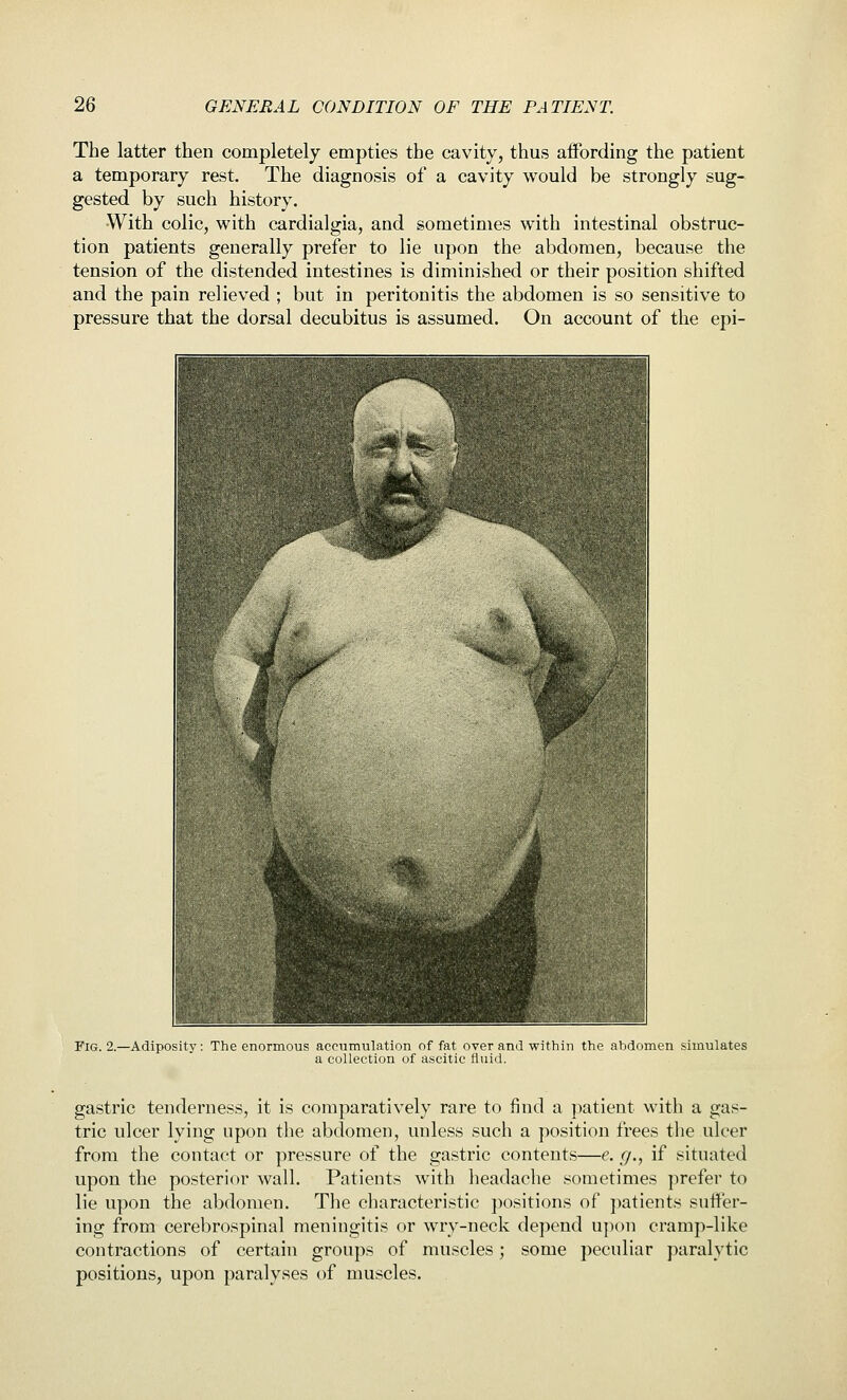 The latter then completely empties the cavity, thus affording the patient a temporary rest. The diagnosis of a cavity would be strongly sug- gested by such history. With colic, with cardialgia, and sometimes with intestinal obstruc- tion patients generally prefer to lie upon the abdomen, because the tension of the distended intestines is diminished or their position shifted and the pain relieved ; but in peritonitis the abdomen is so sensitive to pressure that the dorsal decubitus is assumed. On account of the epi- FiG. 2.—Adiposity: The enormous accumulation of fat over and within the abdomen simulates a collection of ascitic fluid. gastric tenderness, it is comparatively rare to find a patient with a gas- tric ulcer lying upon the abdomen, unless such a position frees the ulcer from the contact or pressure of the gastric contents—e. g., if situated upon the posterior wall. Patients with lieadache sometimes prefer to lie upon the abdomen. The characteristic positions of patients suffer- ing from cerebrospinal meningitis or wry-neck depend upon cramp-like contractions of certain groups of muscles; some peculiar paralytic positions, upon paralyses of muscles.