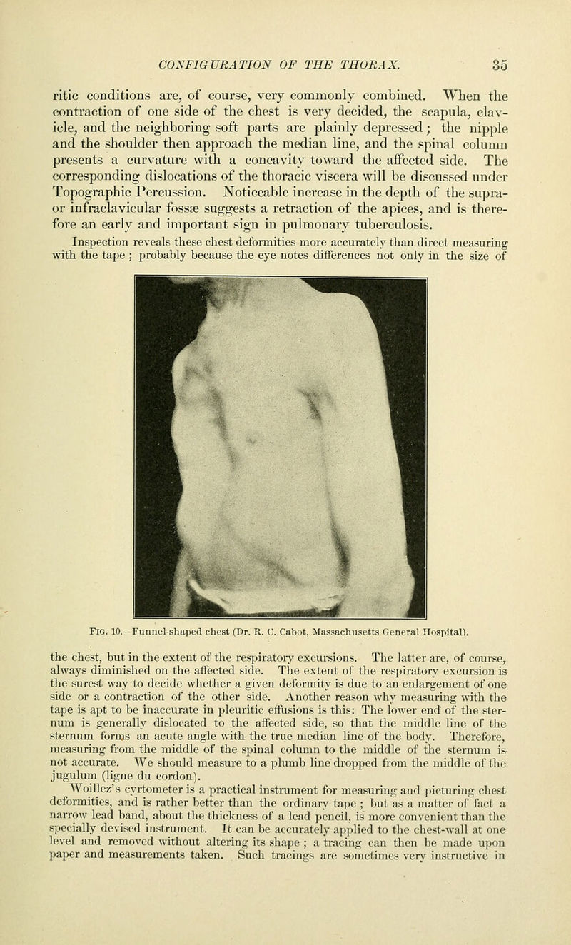 ritic conditions are, of course, very commonly combined. When the contraction of one side of the chest is very decided, the scapula, clav- icle, and the neighboring soft parts are plainly depressed; the nipple and the shoulder then approach the median line, and the spinal column presents a curvature with a concavity toward the affected side. The corresponding dislocations of the thoracic viscera will be discussed under Topographic Percussion. Noticeable increase in the depth of the supra- or infraclavicular fossae suggests a retraction of the apices, and is there- fore an early and important sign in pulmonary tuberculosis. Inspection reveals these chest deformities more accurately than direct measuring with the tape ; probably because the eye notes differences not only in the size of Fig. 10.—Funnel-shaped chest (Dr. R. 0. Cabot, Massachusetts General Hospital). the chest, but in the extent of the respiratory excursions. The latter are, of course, always diminished on the affected side. The extent of the respiratory excursion is the surest way to decide whether a given deformity is due to an enlargement of one side or a contraction of the other side. Another reason why measuring with the tape is apt to be inaccurate in pleuritic effusions is this: The lower end of the ster- num is generally dislocated to the affected side, so that the middle line of the sternum forms an acute angle with the true median line of the body. Therefore, measuring from the middle of the spinal column to the middle of the sternum is not accurate. We should measure to a plumb line dropped fi'om the middle of the jugulum (ligne du cordon). Woillez's cyrtometer is a practical instrument for measuring and picturing chest deformities, and is rather better than the ordinary tape ; but as a matter of fact a narrow lead band, about the thickness of a lead pencil, is more convenient than the specially devised instrument. It can be accurately applied to the chest-wall at one level and removed without altering its shape ; a tracing can then be made upon paper and mea.surements taken. Such tracings are sometimes very instructive in