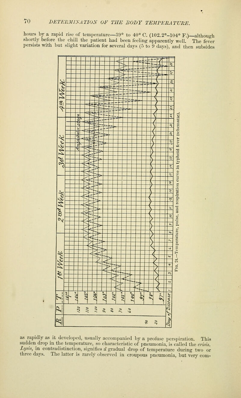 hours by a rapid rise of temperature—39° to 40° C. (102.2°-104° F.)—although shortly before the chill the patient had been feehng apparently well. The fever persists with but slight variation for several days (5 to 9 days), and then subsides -i' 1 1 J i-l-+-l-^Tl ^  ' A: ^ ■ T^' ■ L ?}■ •j; p- ;^ ^■~''- ^ ;::. K$a '■■■•-.7 — \ ^ ^ Z.-'.'—- / h^ '^'~-~'. V -3^ ^1 - ^:^^:--—-\  / ^ ~~':z—- >_ -^ CD ■ — ; 3 ^ I S-^ifK^- — 7 s A ^ § ji 1'. —— X. •° ^^ ^-•~-:^ X A  ^ %^^::-'-'^ 7 r ^ ^ •••..— — : t ^ > ^ ^\:^----=^ _ t '-'' '^ ■^ ^ ^~~~->. V =! -C f^ -^S-'- r ' o >^ ■■^■—a,. V <> t *Cl ...■ . .-■ ^ r  1^ ^ ^z:- V ' t a . •-■■,-' r - 'z : r ^ > ^i-' -^ t ' i ^:^-s. t ^ - r c 'j '■■•- -L L 5 s '^ ■^'-' - h- 2 ^ •••-.-~-~,^ - ^^ ^ £ ^ ^^' h- - o \ '^ ^ ^1 •ii- ? ■■ 3 Kl '^--^ V -§ o CV ..--^---^ y - £ \ *^ s« •■•■ ---'^^ Y •- 5 --■<-T \ '-- i y ..--'^ / ^ ■•- IT ~-. ^^ ^^ '- 1 ^ ^ie'' -^  ^ ^ ^ :.-•-- V ■ 1 K^ ■•■ <?'' -V ' ^ ^ ■■■•^^-=^ \ * d ^ ^^-^ Z  1 % -z- ->-^ \ -'- ^ ^ ^- -*'' /  ^ ^_ <^ -' -4 •-. ■-•^ _S^ - ^i 1- °^ 1 1 *^ s 1 ^ T ^ ^ ^ k 1 ^ ^ i; 1 f^i 5 S ! 5 « i 3 ^ Q «^ as rapidly as it developed, usually accompanied by a profuse perspiration. This sudden drop in the temperature, so characteristic of pneumonia, is called the crisis. Lysis, in contradistinction, signifies a' gradual drop of temperature during two or three days. The latter is rarely observed in croupous pneumonia, but very com-