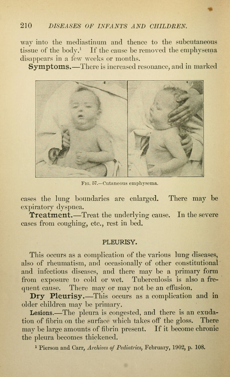 way into the mediastinum and thence to the subcutaneous tissue of the body.1 If the cause be removed the emphysema disappears in a few weeks or months. Symptoms.—There is increased resonance, and in marked Fig. 57.—Cutaneous emphysema. cases the lung boundaries are enlarged. There may be expiratory dyspnea. Treatment.—Treat the underlying cause. In the severe cases from coughing, etc., rest in bed. PLEURISY. This occurs as a complication of the various lung diseases, also of rheumatism, and occasionally of other constitutional and infectious diseases, and there may be a primary form from exposure to cold or wet. Tuberculosis is also a fre- quent cause. There may or may not be an effusion. Dry Pleurisy.—This occurs as a complication and in older children may be primary. Lesions.—The pleura is congested, and there is an exuda- tion of fibrin on the surface which takes off the gloss. There may be large amounts of fibrin present. If it become chronic the pleura becomes thickened. 1 Pierson and Carr, Archives of Pediatrics, February, 1902, p. 108.