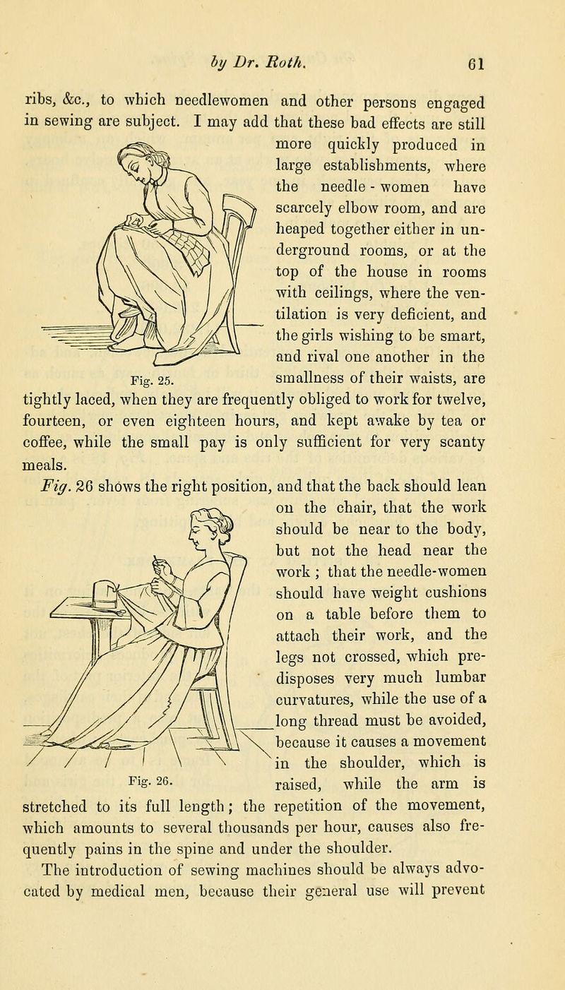 ribs, &c, to which needlewomen and other persons engaged in sewing are subject. I may add that these bad effects are still more quickly produced in large establishments, where the needle - women have scarcely elbow room, and are heaped together either in un- derground rooms, or at the top of the house in rooms with ceilings, where the ven- tilation is very deficient, and the girls wishing to be smart, and rival one another in the smallness of their waists, are tightly laced, when they are frequently obliged to work for twelve, fourteen, or even eighteen hours, and kept awake by tea or coffee, while the small pay is only sufficient for very scanty meals. Fig. 26 shows the right position, and that the back should lean on the chair, that the work should be near to the body, but not the head near the work ; that the needle-women should have weight cushions on a table before them to attach their work, and the legs not crossed, which pre- disposes very much lumbar curvatures, while the use of a long thread must be avoided, because it causes a movement in the shoulder, which is raised, while the arm is stretched to it's full length; the repetition of the movement, which amounts to several thousands per hour, causes also fre- quently pains in the spine and under the shoulder. The introduction of sewing machines should be always advo- cated by medical men, because their general use will prevent Fig. 26.