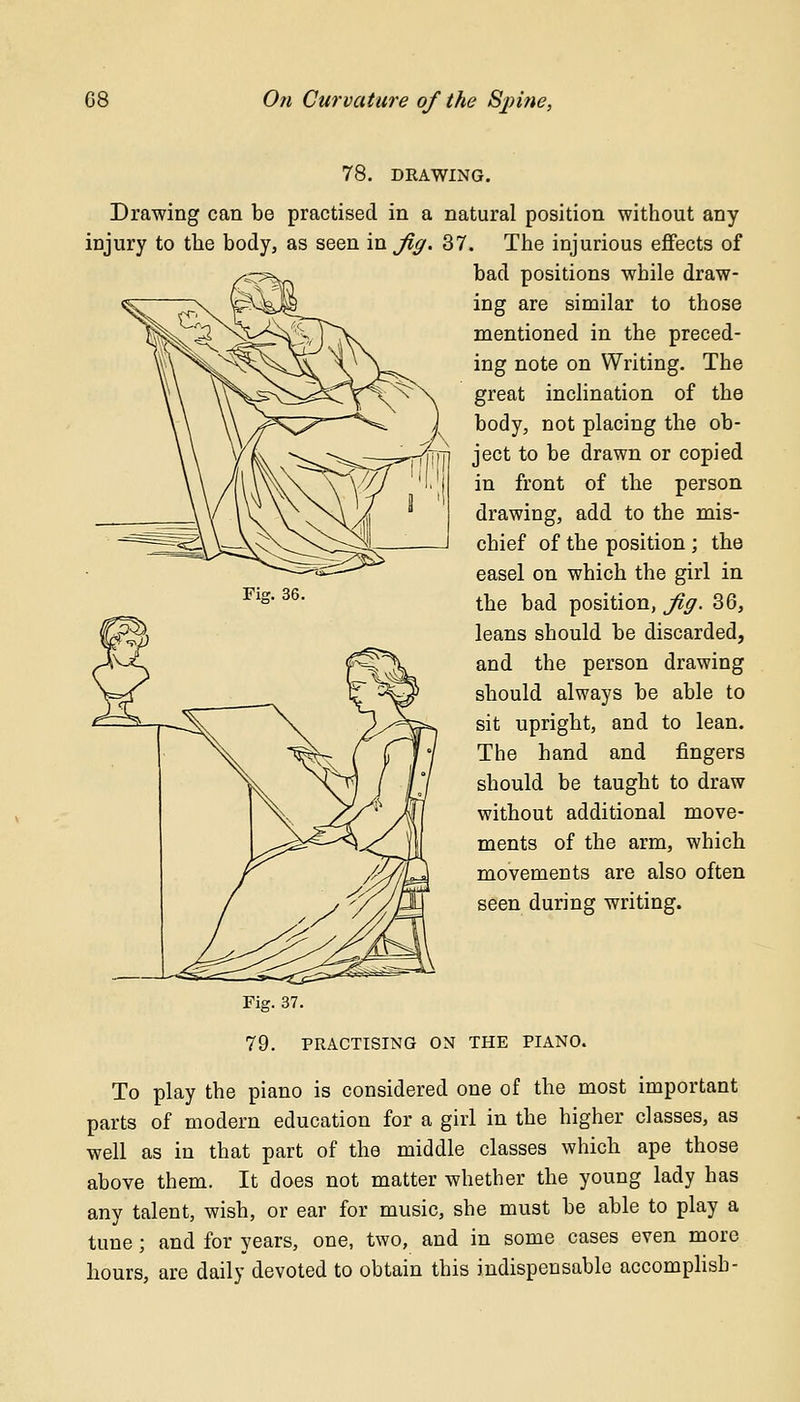 78. DRAWING. Drawing can be practised in a natural position without any injury to the body, as seen in Jig. 37. The injurious effects of bad positions while draw- ing are similar to those mentioned in the preced- ing note on Writing. The great inclination of the body, not placing the ob- ject to be drawn or copied in front of the person drawing, add to the mis- chief of the position ; the easel on which the girl in the bad position, Jig. 36, leans should be discarded, and the person drawing should always be able to sit upright, and to lean. The hand and ringers should be taught to draw without additional move- ments of the arm, which movements are also often seen during writing. Fig. 37. 79. PRACTISING ON THE PIANO. To play the piano is considered one of the most important parts of modern education for a girl in the higher classes, as well as in that part of the middle classes which ape those above them. It does not matter whether the young lady has any talent, wish, or ear for music, she must be able to play a tune; and for years, one, two, and in some cases even more hours, are daily devoted to obtain this indispensable accomplish-