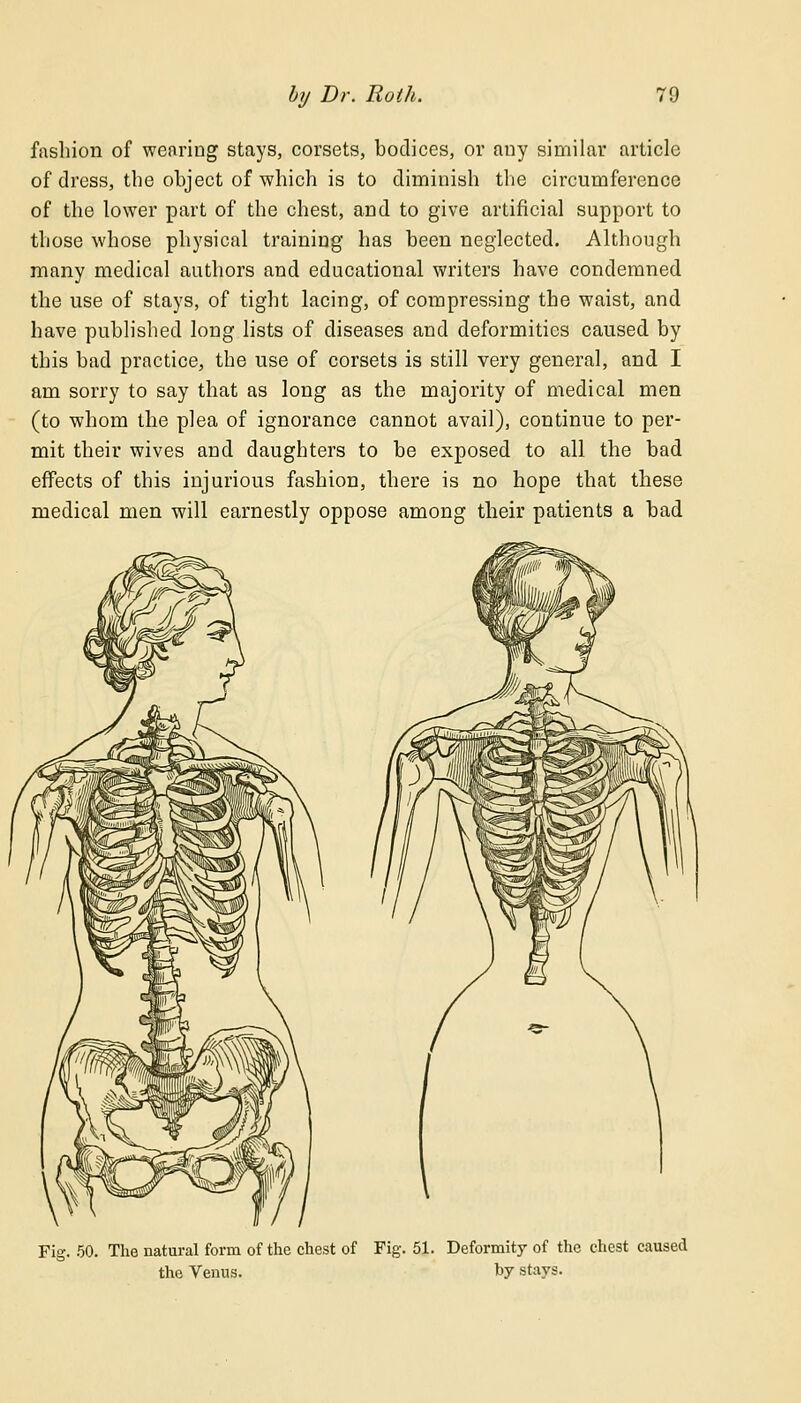 fashion of wearing stays, corsets, bodices, or any similar article of dress, the object of which is to diminish the circumference of the lower part of the chest, and to give artificial support to those whose physical training has been neglected. Although many medical authors and educational writers have condemned the use of stays, of tight lacing, of compressing the waist, and have published long lists of diseases and deformities caused by this bad practice, the use of corsets is still very general, and I am sorry to say that as long as the majority of medical men (to whom the plea of ignorance cannot avail), continue to per- mit their wives and daughters to be exposed to all the bad effects of this injurious fashion, there is no hope that these medical men will earnestly oppose among their patients a bad Fig. 50. The natural form of the chest of Fig. 51. Deformity of the chest caused the Venus. by stays.