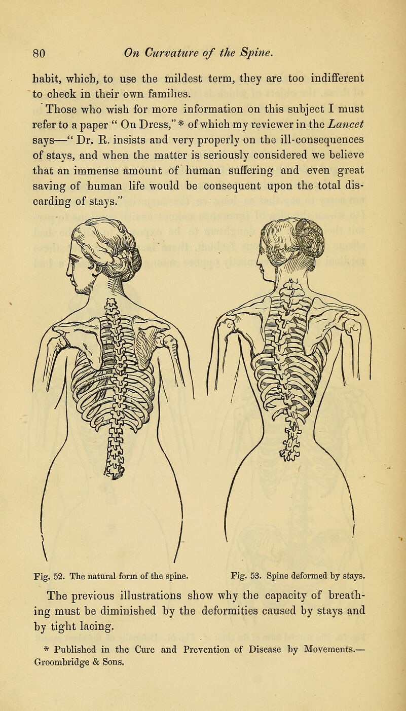 habit, which, to use the mildest term, they are too indifferent to check in their own families. Those who wish for more information on this subject I must refer to a paper  On Dress,* of which my reviewer in the Lancet says— Dr. E. insists and very properly on the ill-consequences of stays, and when the matter is seriously considered we believe that an immense amount of human suffering and even great saving of human life would be consequent upon the total dis- carding of stays. Fig. 52. The natural form of the spine. Fig. 53. Spine deformed by stays. The previous illustrations show why the capacity of breath- ing must be diminished by the deformities caused by stays and by tight lacing. * Published in the Cure and Prevention of Disease by Movements.— Groombridge & Sons.