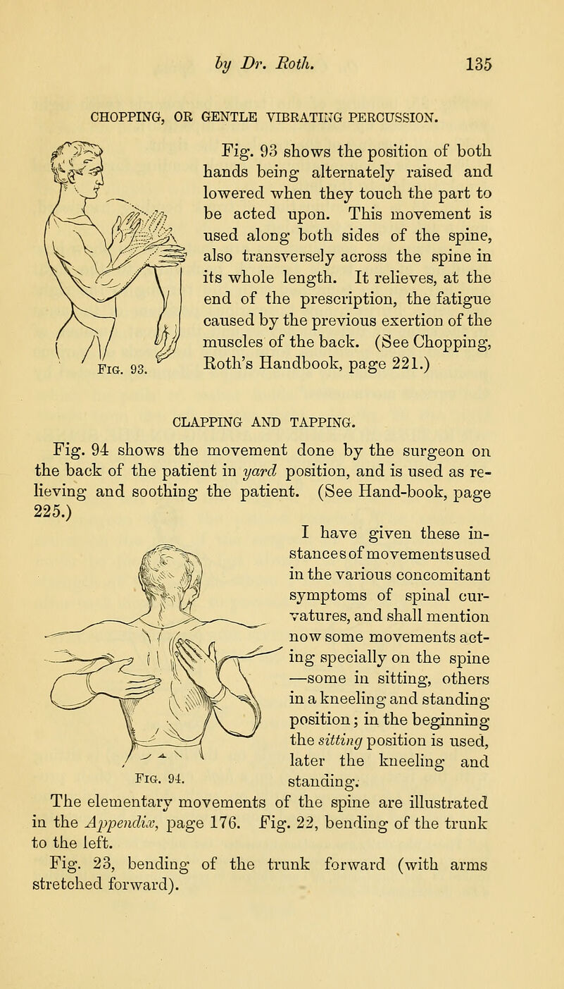 CHOPPING, OR GENTLE VIBRATING PERCUSSION. Fig. 93 shows the position of both hands being alternately raised and lowered when they touch the part to be acted upon. This movement is used along both sides of the spine, also transversely across the spine in its whole length. It relieves, at the end of the prescription, the fatigue caused by the previous exertion of the muscles of the back. (See Chopping, Roth's Handbook, page 221.) CLAPPING AND TAPPING. Fig. 94 shows the movement done by the surgeon on the back of the patient in yard position, and is used as re- lieving and soothing the patient. (See Hand-book, page 225.) I have given these in- stances of movementsused in the various concomitant symptoms of spinal cur- vatures, and shall mention now some movements act- ing specially on the spine —some in sitting, others in a kneeling and standing- position ; in the beginning the sitting position is used, later the kneeling and FlG« Q4- standing. The elementary movements of the spine are illustrated in the Appendix, page 176. Fig. 22, bending of the trunk to the left. Fig. 23, bending of the trunk forward (with arms stretched forward).