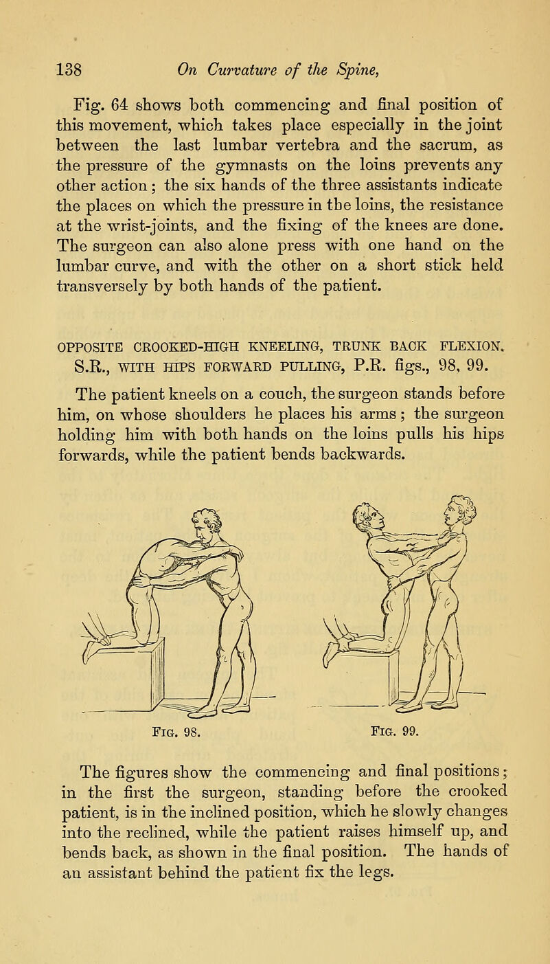 Fig. 64 shows both commencing and final position of this movement, which takes place especially in the joint between the last lumbar vertebra and the sacrum, as the pressure of the gymnasts on the loins prevents any other action ; the six hands of the three assistants indicate the places on which the pressure in the loins, the resistance at the wrist-joints, and the fixing of the knees are done. The surgeon can also alone press with one hand on the lumbar curve, and with the other on a short stick held transversely by both hands of the patient. OPPOSITE CROOKED-HIGH KNEELING, TRUNK BACK FLEXION. S.R., WITH HIPS FORWARD PULLING, P.R. figs., 98, 99. The patient kneels on a couch, the surgeon stands before him, on whose shoulders he places his arms; the surgeon holding him with both hands on the loins pulls his hips forwards, while the patient bends backwards. Fig. Fig. 99. The figures show the commencing and final positions; in the first the surgeon, standing before the crooked patient, is in the inclined position, which he slowly changes into the reclined, while the patient raises himself up, and bends back, as shown in the final position. The hands of an assistant behind the patient fix the legs.