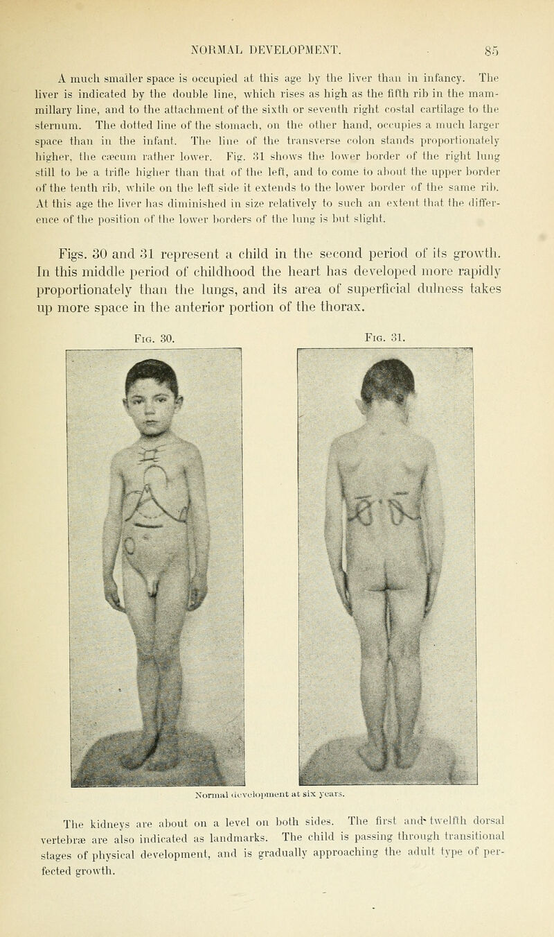 A much smaller space is occupied at this age hy the liver than in infancy. The liver is indicated by the double line, which rises as high as the fifth rib in the mam- miliary line, and to the attachment of the sixth or seventh right costal cartilage to the sternum. The dotted line of the stomach, on the other hand, occupies a much larger space than in the infant. The line of the transverse colon stands proportionately higher, the c*cum rather lower. Fig. 31 shows the lower border of the right lung still to be a trifle higher than that of the left, and to come to about the upper border of the tenth rib, while on the left side it extends to the lower border of the same rib. At this age the liver has diminished in size relatively to such an extent that the differ- ence of the position of the lower borders of the lung is but slight. Figs. 30 and 31 represent a child in the second period of its growth. In this middle period of childhood the heart has developed more rapidly proportionately than the lungs, and its area of superficial dulness takes up more space in the anterior portion of the thorax. Fig. 30. Fig. 31. J N<inii;il ucvolopment al six y The kidneys are about on a level on both sides. The first and^welfth dorsal vertebrse are also indicated as landmarks. The child is passing through transitional stages of physical development, and is gradually approaching the adult type of per- fected growth.