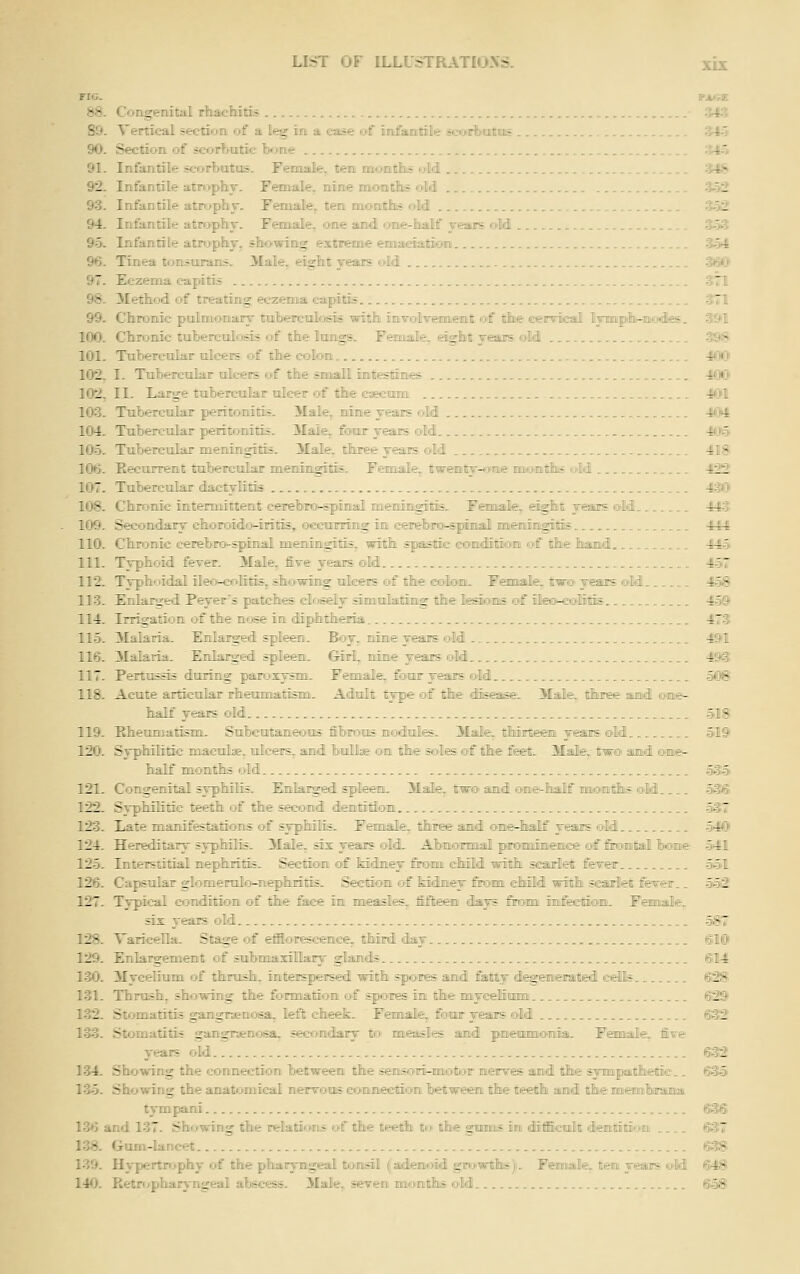 Flu. e^At'-tE. bS. Congenital rhachitis • 94^ 89. Vertical section of a leg in a case of mfauatile so>irfctitnis ^5 90. Section of scorbutic Ixme ^5 91. Infantile scorbutus. Fenaale, ten, tnont&s oM xil& 92. Infantile atrophy. Female, nine naontlLS O'M S52 93. Infantile atruphy. Female^ ten niontii« oM S52 94. Infantile atrophy. Female, one ajid one-half years old S53 9o. Infantile atrophy, showing extreme emaciation 351 96. Tinea tonsurans, ilaie, eight years old 360 97. Eczema capitis 311 98. Method of treating eczema capitis 371 99. Chronic pulmonary tuberculosis with iavoilveraiiemt rf the cervical IvrnDt-n'-nles. 3!^1 100. Chronic tuberculosis of the lungs. Femuale, sight years oM .. .^S 101. Tubercular ulcers of the colon li,«i> 102. I. Tubercular ulcers of the small intestines -IfjO 102. II. Large tubercular ulcer of the caecum -M^l 103. Tubercular peritonitis. Male, nine years c^M 404 104. Tubercular peritonitis. 3Iaie, four yeajrs old 4l!)& 105. Tubercular meningitis. Male, three yea.rs old 418 106. Eecurrent tuberculajr Btteningitis- Fenaale^ twentTHome mioiaililiis wM -V^ 107. Tubercular dactylitis 430 108. Chronic intermittent cerebro-spimal meningitis. Femaiale,. eight years ©iM 443 109. Secondary choroido-iritis, oecurring in eerebro-spimal mieningitis 444 110. Chronic cerebro-spinal meningitis, with spastie conieiitioim &>€ tine ban I 445 111. Typhoid fever. 3Iale, five years old 457 112. TjrphMidal ileo-colitis, showing tilcers of the colon. Fesoaiale. two- years old 458 113. Enlariced Peyer's patches closely simulating the lesions of ileoMjolitis 45© 114. Irrigation of the nose in diphtheria. 473 115. Malaria. Enlarged spleen. B<3y, nime years old 49tl 116. Malaria. Enlarged spleen. Girl, nine years old 4S3 117. Pertussis during paroxysm. Female, four years old 56® 118. Acute articular rheumatism. Adult tjpe of ^he dfeease. Male, three aisd ©iime- half years old 518 119. Eheumatism. Subcutaneous fibrous nodules. 31ale. thirteen years ©M 519 120. Syphilitic maculae, ulcers, and bullae on the soles rrf the feet. Male,, tw© and one- half months old . '35 121. Congenital syphilis. Enlarged spleen. Male, ;:; . uz.a jne-lBallf moietSis '3® 122. Syphilitic teeth of the second dentition - ;?7 123. Late manifestations of syphilis. Female, three and ©ne^lialf years oM -54C 124. Hereditary syphilis. Male, six years old. Abmormal pronoinence of firontal home 541 125. Interstitial nephritis. Section of Mdmey firom ehiiM with scarlet fever 551 126. Capsular glomerulo-nephritis. Section of kidney firomi child with scarlet fever.. 553 127. Typical condition of the fece im laeasles^ fifljeen days feorai imfeciiom- Feaoiale,. six years old 587 128. Varicella. Stage of effioreseenee, thm^ ^j §W 129. Enlargement of submaxillary glands fsiM 130. Mycelium of thrush, interspersed with spores and fatty degenerated eeMs ®28 131. Thrush, showing the formation of spores in the mycelium 629 132. Stomatitis gangrenosa, letT; cheek. Female, four years old @32 133. Stomatitis gangrjjenosa, secondary to measles and pneaanonia. Female,, five years old 632 134. Showing the connection between the sensori-naioitor meirves and the sympathetiffi-.. ©35 135. Showing the anatomical nervous connectiom between! the teeth and the nmefflffllMrajaia tympani fSi3® 136 and 137. Showing the relations of the teeth to the gramns in drfficrft demtitioim 637 138. Gum-lancet 638 139. Hypertn^phy of the pharj-ngeal tonsil (adenoid gm>wtlK)i. Femiale. ttem jeaiis &M (MS 140. Retropharj'n<;eal .■iTi--</i-s.-;. >ralt- seven mo-nths old. . . h'.SR