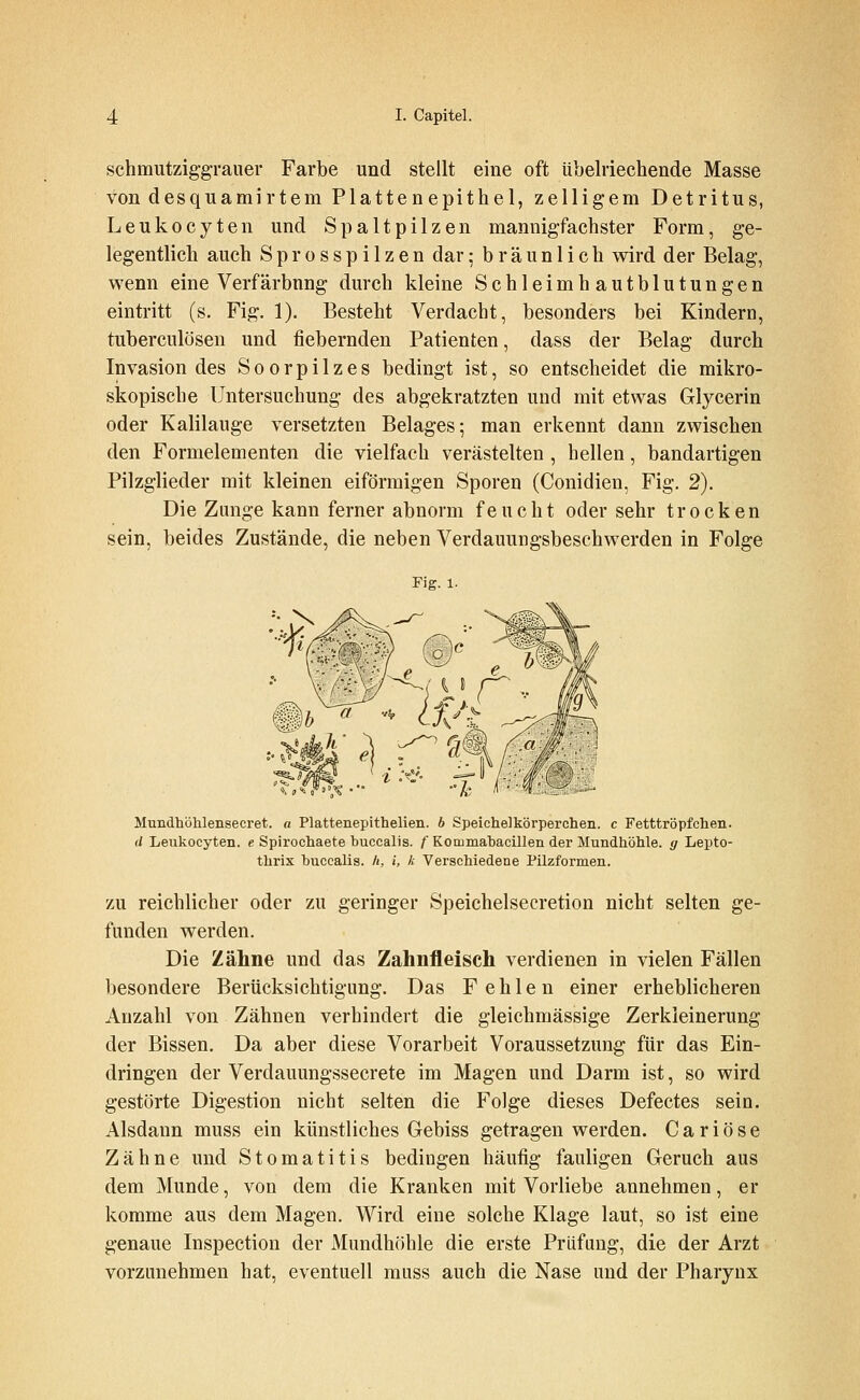schmutzig-grauer Farbe und stellt eine oft übelriechende Masse von desquamirtem Plattenepithel, zelligem Detritus, Leukocyten und Spaltpilzen mannigfachster Form, ge- legentlich auch Sprosspilzen dar; bräunlich wird der Belag, wenn eine Verfärbung durch kleine Schleimhautblutungen eintritt (s, Fig. 1). Besteht Verdacht, besonders bei Kindern, tuberculösen und fiebernden Patienten, dass der Belag durch Invasion des Soorpilzes bedingt ist, so entscheidet die mikro- skopische Untersuchung des abgekratzten und mit etwas Glycerin oder Kalilauge versetzten Belages; man erkennt dann zwischen den Formelementen die vielfach verästelten , hellen, bandartigen Pilzglieder mit kleinen eiförmigen Sporen (Conidien, Fig. 2). Die Zmige kann ferner abnorm feucht oder sehr trocken sein, beides Zustände, die neben Verdauungsbeschwerden in Folge Pig. 1. Mundböhlensecret. a Plattenepithelien. b Speichelkörperohen. c Fetttröpfchen. d Leukocyten. e Spirocliaete buccalis. f Korumabacillen der Mundhöhle, g Lepto- thrix buccalis. h, i, k Verschiedene Pilzformen. ZU reichlicher oder zu geringer Speichelsecretion nicht selten ge- funden werden. Die Zähne und das Zahnfleisch verdienen in vielen Fällen besondere Berücksichtigung. Das Fehlen einer erheblicheren Anzahl von Zähnen verhindert die gleichmässige Zerkleinerung der Bissen. Da aber diese Vorarbeit Voraussetzung für das Ein- dringen der Verdauungssecrete im Magen und Darm ist, so wird gestörte Digestion nicht selten die Folge dieses Defectes sein. Alsdann muss ein künstliches Gebiss getragen werden. C a r i ö s e Zähne und Stomatitis bedingen häufig fauligen Geruch aus dem Munde, von dem die Kranken mit Vorliebe annehmen, er komme aus dem Magen. Wird eine solche Klage laut, so ist eine genaue Inspection der Mundhöhle die erste Prüfung, die der Arzt vorzunehmen hat, eventuell muss auch die Nase und der Pharynx
