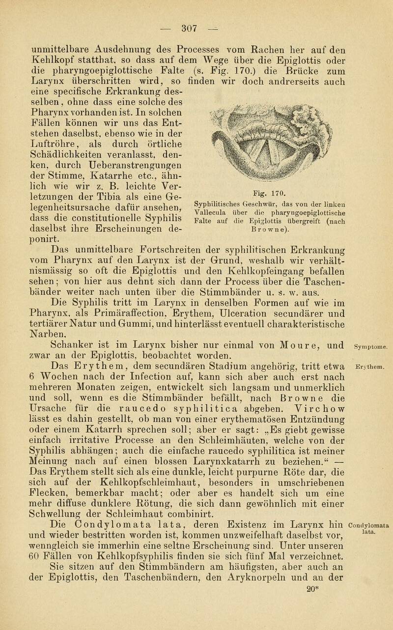 Fig. 170, Syphilitisches Geschwür, das von der linken Vallecula über dio pharyngoepiglottische Falte auf die Epiglottis übergreift (nach Browne). unmittelbare Ausdehnung des Processes vom Rachen her auf den Kehlkopf statthat, so dass auf dem Wege über die Epiglottis oder die pharyngoepiglottische Falte (s. Fig. 170.) die Brücke zum Larynx überschritten wird, so finden wir doch andrerseits auch eine specifische Erkrankung des- selben , ohne dass eine solche des Pharynx vorhanden ist. In solchen Fällen können wir uns das Ent- stehen daselbst, ebenso wie in der Luftröhre, als durch örtliche Schädlichkeiten veranlasst, den- ken, durch Ueberanstrengungen der Stimme, Katarrhe etc., ähn- lich wie wir z, B. leichte Ver- letzungen der Tibia als eine Ge- legenheitsursache dafür ansehen, dass die constitutionelle Syphilis daselbst ihre Erscheinungen de- ponirt. Das unmittelbare Fortschreiten der syphilitischen Erkrankung vom Pharynx auf den Larynx ist der Grund, weshalb wir verhält- nismässig so oft die Epiglottis und den Kehlkopfeingang befallen sehen; von hier aus dehnt sich dann der Process über die Taschen- bänder weiter nach unten über die Stimmbänder u. s. w. aus. Die Syphilis tritt im Larynx in denselben Formen auf wie im Pharynx, als Primäraffection, Erythem, Ulceration secundärer und tertiärer Natur und Gummi, und hinterlässt eventuell charakteristische Narben. Schanker ist im Larynx bisher nur einmal von Moure, und zwar an der Epiglottis, beobachtet worden. Das Erythem, dem secundären Stadium angehörig, tritt etwa 6 Wochen nach der Infection auf, kann sich aber auch erst nach mehreren Monaten zeigen, entwickelt sich langsam und unmerklich und soll, wenn es die Stimmbänder befällt, nach Browne die Ursache für die raucedo syphilitica abgeben, Yirchow lässt es dahin gestellt, ob man von einer erythematösen Entzündung oder einem Katarrh sprechen soll; aber er sagt: „Es giebt gewisse einfach irritative Processe an den Schleimhäuten, welche von der Syphilis abhängen; auch die einfache raucedo syphilitica ist meiner Meinung nach auf einen blossen Larynxkatarrh zu beziehen, — Das Erythem stellt sich als eine dunkle, leicht purpurne Röte dar, die sich auf der Kehlkopfschleimhaut, besonders in umschriebenen Flecken, bemerkbar macht; oder aber es handelt sich um eine mehr diffuse dunklere Rötung, die sich dann gewöhnlich mit einer Schwellung der Schleimhaut combinirt. Die Oondylomata lata, deren Existenz im Larynx hin Condyiomata und wieder bestritten worden ist, kommen unzweifelhaft daselbst vor, wenngleich sie immerhin eine seltne Erscheinung sind. Unter unseren 60 Fällen von Kehlkopfsyphilis finden sie sich fünf Mal verzeichnet. Sie sitzen auf den Stimmbändern am häufigsten, aber auch an der Epiglottis, den Taschenbändern, den Aryknorpeln und an der 20* Erythem. lata.