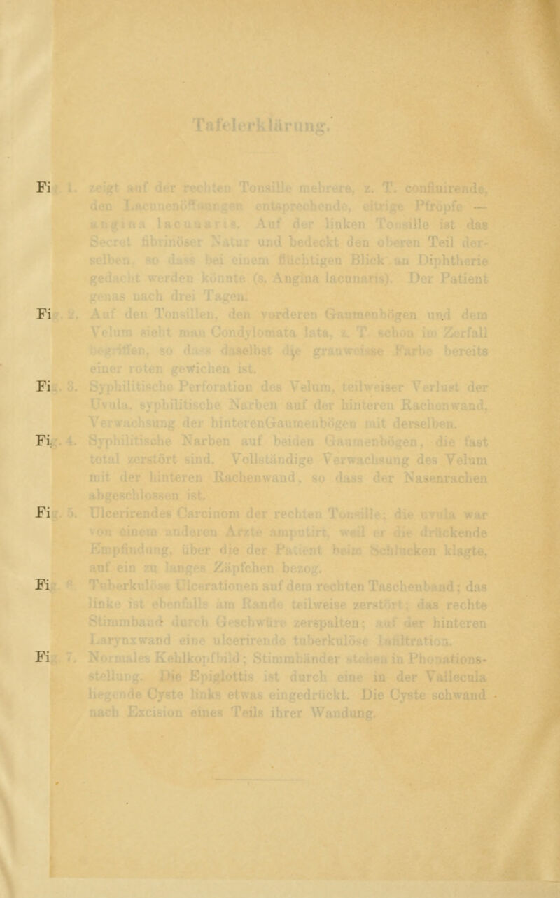 Fi Fi Fi Fi Fi Fi Fi