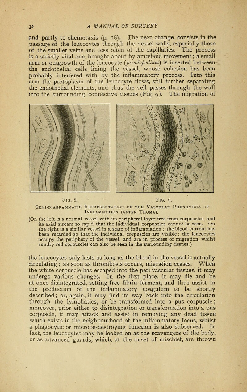 and partly to chemotaxis (p. i8). The next change consists in the passage of the leucocytes through the vessel walls, especially those of the smaller veins and less often of the capillaries. The process is a strictly vital one, brought about by amoeboid movement; a small arm or outgrowth of the leucocyte {pseudopodium) is inserted between the endothelial cells lining the vessel, whose cohesion has been probably interfered with by the inflammatory process. Into this arm the protoplasm of the leucocyte flows, still further separating the endothelial elements, and thus the cell passes through the wall into the surrounding connective tissues (Fig. 9). The migration of tiG. 8. • Fig. 9. Semi-diagrammatic Representation of the Vascular Phenomena of Inflammation (after Thoma). (On the left is a normal vessel with its peripheral layer free from corpuscles, and its axial stream so rapid that the individual corpuscles cannot be seen. On the right is a similar vessel in a state of inflammation ; the blood-current has been retarded so that the individual corpuscles are visible; the leucocytes occupy the periphery of the vessel, and are in process of migration, vyhilst sundry red corpuscles can also be seen in the surrounding tissues.) the leucocytes only lasts as long as the blood in the vessel is actually circulating ; as soon as thrombosis occurs, migra4:ion ceases. When the white corpuscle has escaped into the peri-vascular tissues, it may undergo various changes. In the first place, it may die and be at once disintegrated, setting free fibrin ferment, and thus assist in the production of the inflammatory coagulum to be shortly described; or, again, it may find its way back into the circulation through the lymphatics, or be transformed into a pus corpuscle; moreover, prior either to disintegration or transformation into a pus corpuscle, it may attack and assist in removing any dead tissue which exists in the neighbourhood of the inflammatory focus, whilst a phagocytic or microbe-destroying function is also subserved. Ir, fact, the leucocytes may be looked on as the scavengers of the body, or as advanced guards, which, at the onset of mischief, are thrown