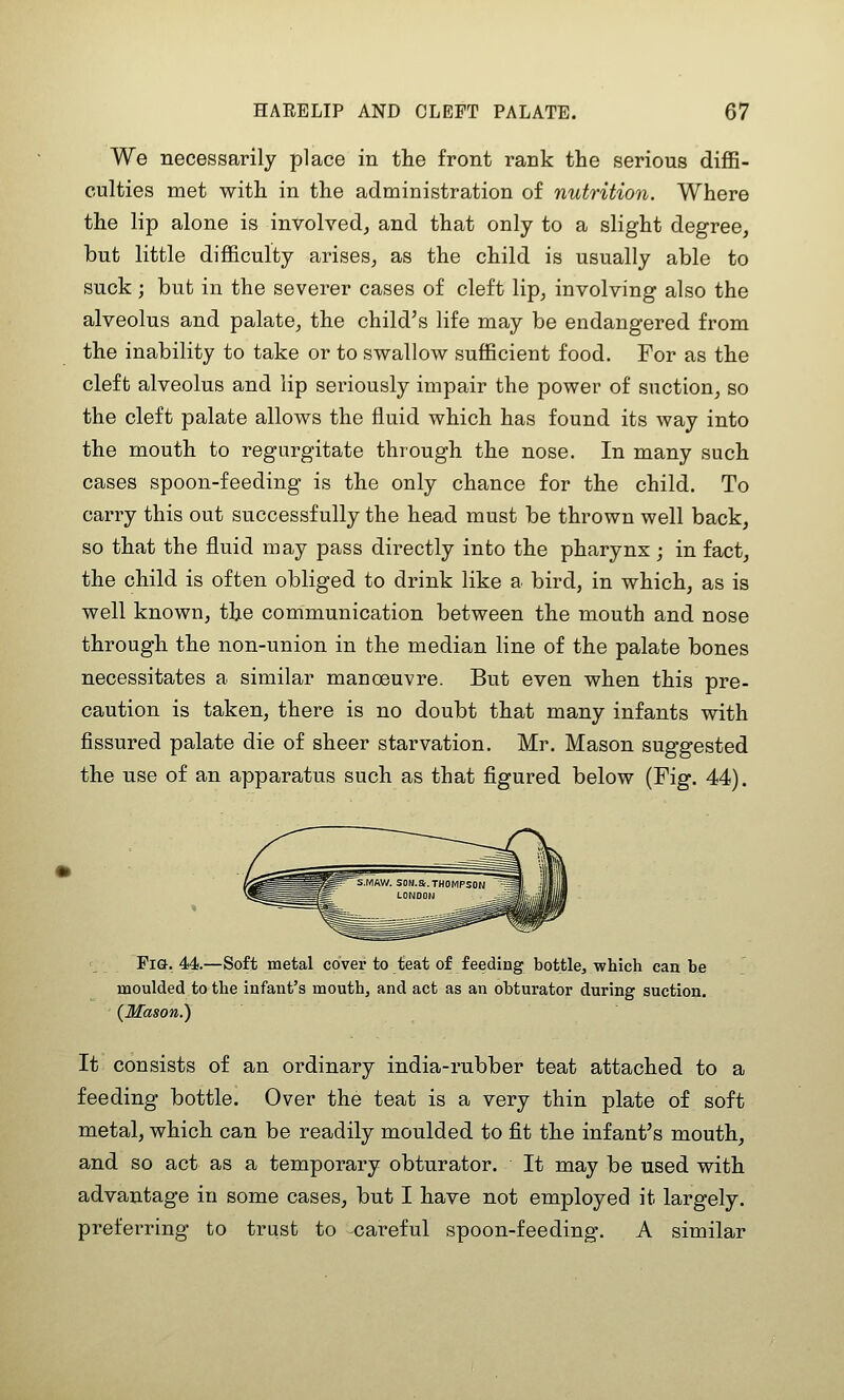 We necessarily place in tlie front rank the serious diflB- culties met witli in the administration of nutrition. Where the lip alone is involved, and that only to a slight degree, but little difficulty arises, as the child is usually able to suck; but in the severer cases of cleft lip, involving also the alveolus and palate, the child's life may be endangered from the inability to take or to swallow sufficient food. For as the cleft alveolus and lip seriously impair the power of suction, so the cleft palate allows the fluid which has found its way into the mouth to regurgitate through the nose. In many such cases spoon-feeding is the only chance for the child. To carry this out successfully the head must be thrown well back, so that the fluid may pass directly into the pharynx; in fact, the child is often obliged to drink like a bird, in which, as is well known, the communication between the mouth and nose through the non-union in the median line of the palate bones necessitates a similar manoeuvre. But even when this pre- caution is taken, there is no doubt that many infants with fissured palate die of sheer starvation. Mr. Mason suggested the use of an apparatus such as that figured below (Fig. 44). Pig. 44.—Soft metal cover to teat of feeding bottle, which can be moulded to the infant's mouth, and act as an obturator during suction. (Mason.) It consists of an ordinary india-rubber teat attached to a feeding bottle. Over the teat is a very thin plate of soft metal, which can be readily moulded to fit the infant's mouth, and so act as a temporary obturator. It may be used with advantage in some cases, but I have not employed it largely, preferring to trust to careful spoon-feeding. A similar