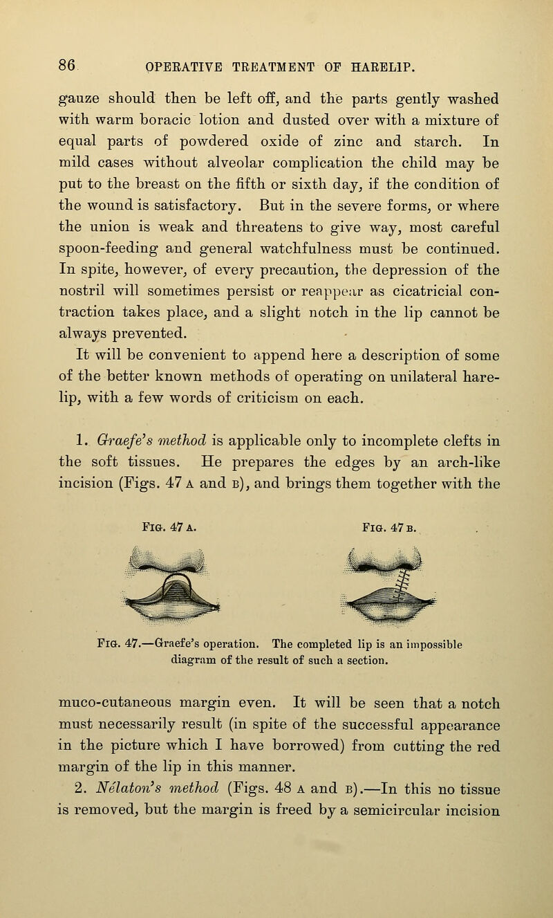 gauze should tlien be left off, and tlie parts gently washed with warm boracic lotion and dusted over with a mixture of equal parts of powdered oxide of zinc and starch. In mild cases without alveolar complication the child may be put to the breast on the fifth or sixth day, if the condition of the wound is satisfactory. But in the severe forms, or where the union is weak and threatens to give way, most careful spoon-feeding and general watchfulness must be continued. In spite, however, of every precaution, the depression of the nostril will sometimes persist or reappear as cicatricial con- traction takes place, and a slight notch in the lip cannot be always prevented. It will be convenient to append here a description of some of the better known methods of operating on unilateral hare- lip, with a few words of criticism on each. 1. Graefe's method is applicable only to incomplete clefts in the soft tissues. He prepares the edges by an aixh-like incision (Figs. 47 a and b), and brings them together with the Fi&. 47 A. Fig. 47 b. Fia. 47.—Graefe's operation. The completed lip is an impossible diagram of the result of such a section. muco-cutaneous margin even. It will be seen that a notch must necessarily result (in spite of the successful appearance in the picture which I have borrowed) from cutting the red margin of the lip in this manner. 2. Nelaton's method (Figs. 48 a and b).—In this no tissue is removed, but the margin is freed by a semicircular incision