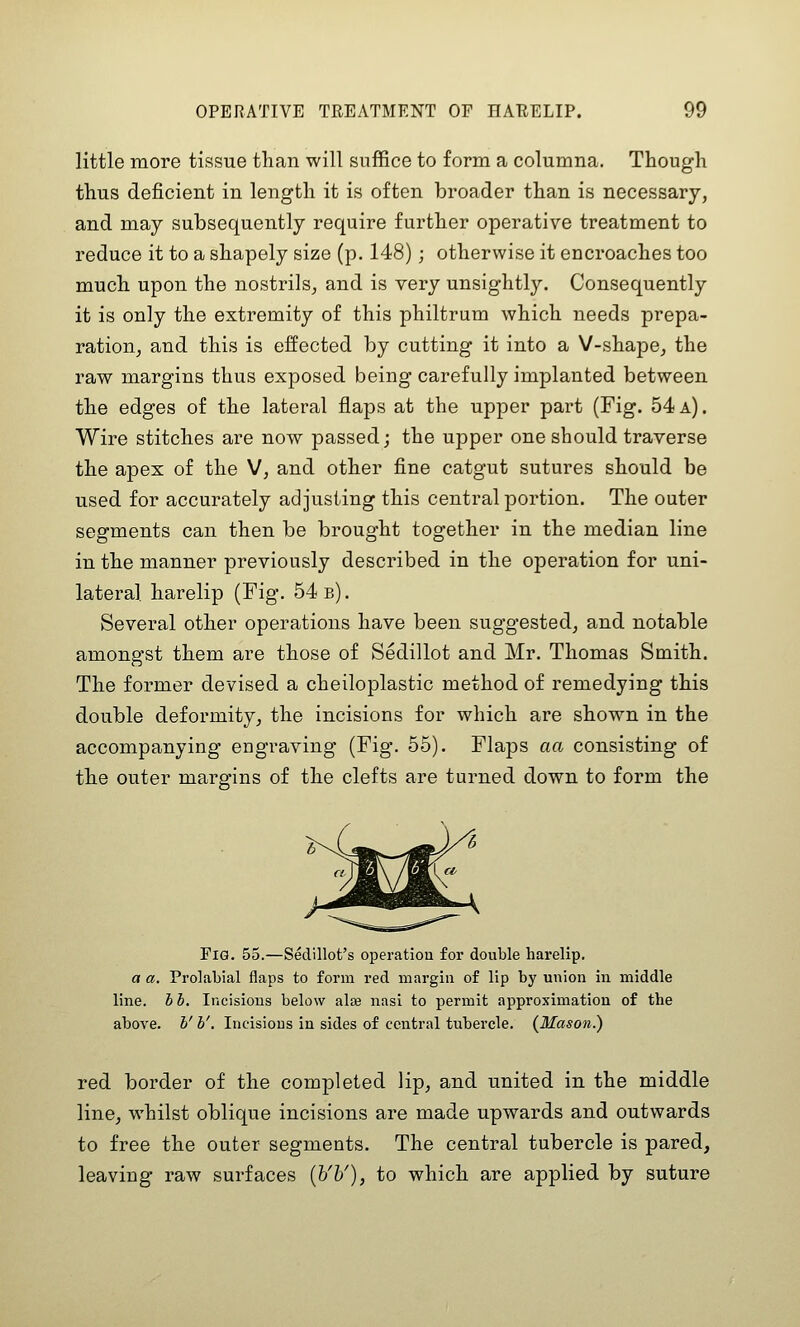 little more tissue than will suffice to form a columna. Though thus deficient in length it is often broader than is necessary, and may subsequently require further operative treatment to reduce it to a shapely size (p. 148); otherwise it encroaches too much upon the nostrils^ and is very unsightly. Consequently it is only the extremity of this philtrum which needs prepa- ration, and this is effected by cutting it into a V-shape, the raw margins thus exposed being carefully implanted between the edges of the lateral flaps at the upper part (Fig. 54 a). Wire stitches are now passed; the upper one should traverse the apex of the V, and other fine catgut sutures should be used for accurately adjusting this central portion. The outer segments can then be brought together in the median line in the manner previously described in the operation for uni- lateral harelip (Fig. 54 b). Several other operations have been suggested, and notable amongst them are those of Sedillot and Mr. Thomas Smith. The former devised a cheiloplastic method of remedying this double deformity, the incisions for which are shown in the accompanying engraving (Fig. 55). Flaps aa consisting of the outer margins of the clefts are turned down to form the Fig. 55.—Sedillot's operation for double harelip. a a, Prolabial flaps to form red margin of lip by union in middle line, h b. Incisions below alse nasi to permit approximation of the above, b' b'. Incisions in sides of central tubercle. {Mason.) red border of the completed lip, and united in the middle line, whilst oblique incisions are made upwards and outwards to free the outer segments. The central tubercle is pared, leaving raw surfaces [h'h'), to which are applied by suture