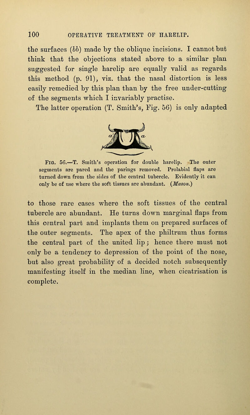 the surfaces (bh) made by the oblique incisious. I cannot but think that the objections stated above to a similar plan suggested for single harelip are equally valid as regards this method (p. 91), viz. that the nasal distortion is less easily remedied by this plan than by the free under-cutting of the segments which I invariably practise. The latter operation (T. Smith's, Fig. 56) is only adapted Fia. 56.—T. Smith's operation for double harelip. The outer segments are pared and the parings removed. Prolabial flaps are turned down from the sides of the central tubercle. Evidently it can only be of use where the soft tissues are abundant. (Mason.) to those rare cases where the soft tissues of the central tubercle are abundant. He turns down marginal flaps from this central part and implants them on prepared surfaces of the outer segments. The apex of the philtrum thus forms the central part of the united lip; hence there must not only be a tendency to depression of the point of the nose, but also great probability of a decided notch subsequently manifesting itself in the median line, when cicatrisation is complete.