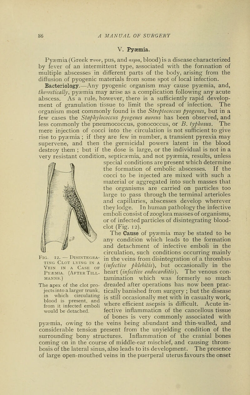 V. Pysemia. Pyaemia (Greek ttvov, pus, and aipa, blood) is a disease characterized by fever of an intermittent type, associated with the formation of multiple abscesses in different parts of the body, arising from the diffusion of pyogenic materials from some spot of local infection. Bacteriology.—Any pyogenic organism may cause pyaemia, and, theoretically, pyaemia may arise as a complication following any acute abscess. As a rule, however, there is a sufficiently rapid develop- ment of granulation tissue to limit the spread of infection. The organism most commonly found is the Streptococcus pyogenes, but in a few cases the Staphylococcus pyogenes aureus has been observed, and less commonly the pneumococcus, gonococcus, or B. typhosus. The mere injection of cocci into the circulation is not sufficient to give rise to pyaemia ; if they are few in number, a transient pyrexia may supervene, and then the germicidal powers latent in the blood destroy them ; but if the dose is large, or the individual is not in a very resistant condition, septicaemia, and not pyaemia, results, unless special conditions are present which determine the formation of embolic abscesses. If the cocci to be injected are mixed with such a material or aggregated into such masses that the organisms are carried on particles too large to pass through the terminal arterioles and capillaries, abscesses develop wherever they lodge. In human pathology the infective emboli consist of zoogloea masses of organisms, or of infected particles of disintegrating blood- clot (Fig. 12). The Cause of pyaemia may be stated to be any condition which leads to the formation and detachment of infective emboli in the circulation, such conditions occurring mainly in the veins from disintegration of a thrombus {infective phlebitis), but occasionally in the heart (infective endocarditis). The venous con- tamination which was formerly so much dreaded after operations has now been prac- tically banished from surgery ; but the disease is still occasionally met with in casualty work, where efficient asepsis is difficult. Acute in- fective inflammation of the cancellous tissue of bones is very commonly associated with pyaemia, owing to the veins being abundant and thin-walled, and considerable tension present from the unyielding condition of the surrounding bony structures. Inflammation of the cranial bones coming on in the course of middle-ear mischief, and causing throm- bosis of the lateral sinus, also leads to its development. The presence of large open-mouthed veins in the puerperal uterus favours the onset Fig. 12. — Disintegra- ting Clot lying in a Vein in a Case of Pyjemia. (After Till- MANNS.) The apex of the clot pro- jects into a larger trunk, in which circulating blood is present, and from it infected emboli would be detached.