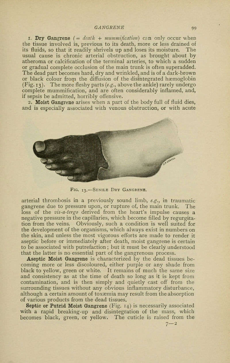 1. Dry Gangrene (= death + mummification) can only occur when the tissue involved is, previous to its death, more or less drained of its fluids, so that it readily shrivels up and loses its moisture. The usual cause is chronic arterial obstruction, as brought about by atheroma or calcification of the terminal arteries, to which a sudden or gradual complete occlusion of the main trunk is often superadded. The dead part becomes hard, dry and wrinkled, and is of a dark-brown or black colour from the diffusion of the disintegrated haemoglobin (Fig. 13). The more fleshy parts (e.g., above the ankle) rarely undergo complete mummification, and are often considerably inflamed, and, if sepsis be admitted, horribly offensive. 2. Moist Gangrene arises when a part of the body full of fluid dies, and is especially associated with venous obstruction, or with acute Fig. 13.—Senile Dry Gangrene. arterial thrombosis in a previously sound limb, e.g., in traumatic gangrene due to pressure upon, or rupture of, the main trunk. The loss of the vis-a-tergo derived from the heart's impulse causes a negative pressure in the capillaries, which become filled by regurgita- tion from the veins. Obviously, such a condition is well suited for the development of the organisms, which always exist in numbers on the skin, and unless the most vigorous efforts are made to render it aseptic before or immediately after death, moist gangrene is certain to be associated with putrefaction; but it must be clearly understood that the latter is no essential part of the gangrenous process. Aseptic Moist Gangrene is characterized by the dead tissues be- coming more or less discoloured, either purple or any shade from black to yellow, green or white. It remains of much the same size and consistency as at the time of death so long as it is kept from contamination, and is then simply and quietly cast off from the surrounding tissues without any obvious inflammatory disturbance, although a certain amount of toxaemia may result from the absorption of various products from the dead tissues. Septic or Putrid Moist Gangrene (Fig. 14) is necessarily associated with a rapid breaking-up and disintegration of the mass, which becomes black, green, or yellow. The cuticle is raised from the 7—2