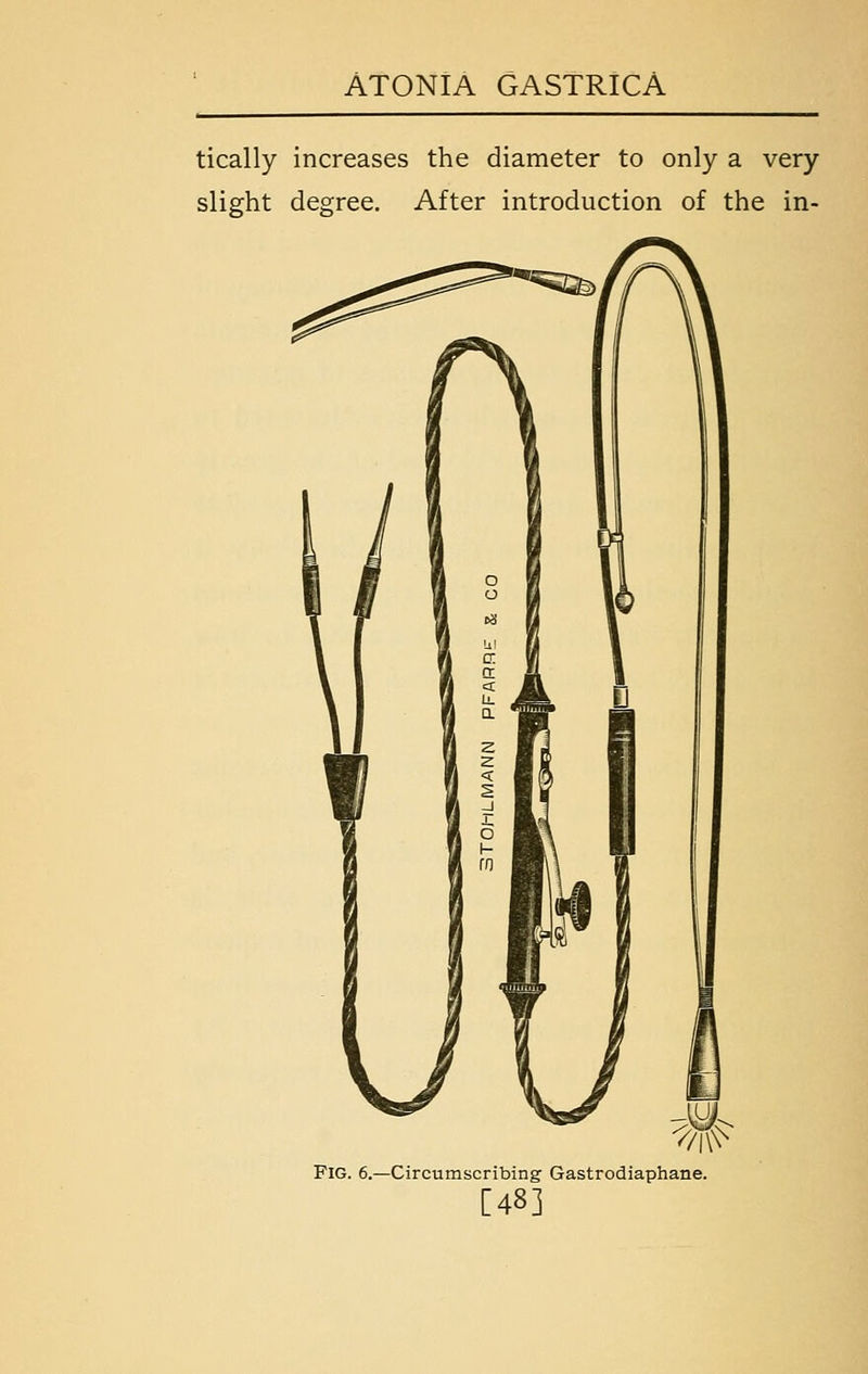 tically increases the diameter to only a very slight degree. After introduction of the in- FlG. 6.—Circumscribing' Gastrodiaphane. [48]