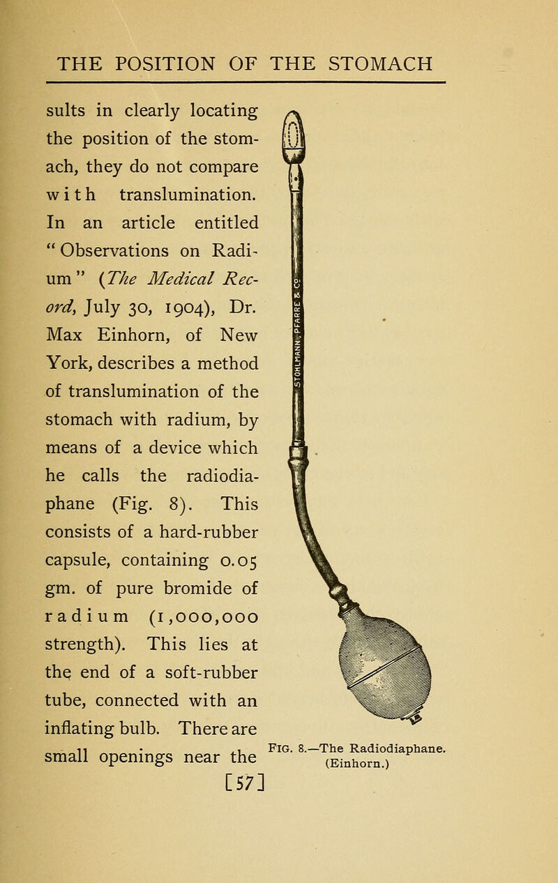 suits in clearly locating the position of the stom- ach, they do not compare with translumination. In an article entitled  Observations on Radi- um  (The Medical Rec- ord, July 30, 1904), Dr. Max Einhorn, of New York, describes a method of translumination of the stomach with radium, by means of a device which he calls the radiodia- phane (Fig. 8). This consists of a hard-rubber capsule, containing 0.05 gm. of pure bromide of radium (1,000,000 strength). This lies at the end of a soft-rubber tube, connected with an inflating bulb. There are small openings near the [57] ■ — „.^ Fig. 8.—The Radiodiaphane. (Einhorn.)