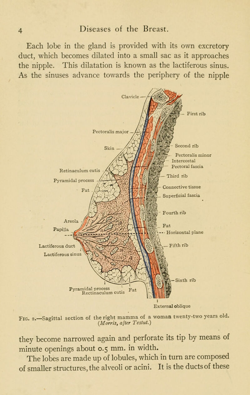 Each lobe in the gland is provided with its own excretory duct, which becomes dilated into a small sac as it approaches the nipple. This dilatation is known as the lactiferous sinus. As the sinuses advance towards the periphery of the nipple Clavicle — ■• Pectoral fascia M Third rib JBSj Connective tissue First rib Second rib Pectoralis minor Intercostal Pyramidal process _ pat Retinaculum cutis ._ Superficial fascia  Fourth rib Kfci- Fat ■ Horizontal plane .... Fifth rib Sixth rib External oblique FIG. 2.—Sagittal section of the right mamma of a woman twenty-two years old. (Morris, after Testut.) they become narrowed again and perforate its tip by means of minute openings about 0.5 mm. in width. The lobes are made up of lobules, which in turn are composed of smaller structures, the alveoli or acini. It is the ducts of these