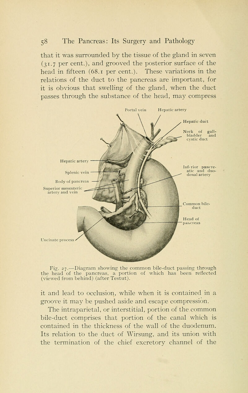 that it was surrounded by the tissue of the gland in seven (31.7 per cent.), and grooved the posterior surface of the head in fifteen (68.1 per cent.). These variations in the relations of the duct to the pancreas are important, for it is obvious that swelling of the gland, when the duct passes through the substance of the head, may compress Portal vein Hepatic artery Hepatic duct Neck of gall- bladder and cystic duct Hepatic artery Splenic vein Body of pancreas Superior mesenteric arterv and vein Infrrior pancre- atic and duo- denal artery Common bile- duct Uncinate process Fig. 27.—Diagram showing the common bile-duct passing through the head of the pancreas, a portion of which has been reflected (viewed from behind) (after Testut). it and lead to occlusion, while when it is contained in a groove it may be pushed aside and escape compression. The intraparietal, or interstitial, portion of the common bile-duct comprises that portion of the canal which is contained in the thickness of the wall of the duodenum. Its relation tO the duct of Wirsung, and its union with the termination of the chief excretory channel of the